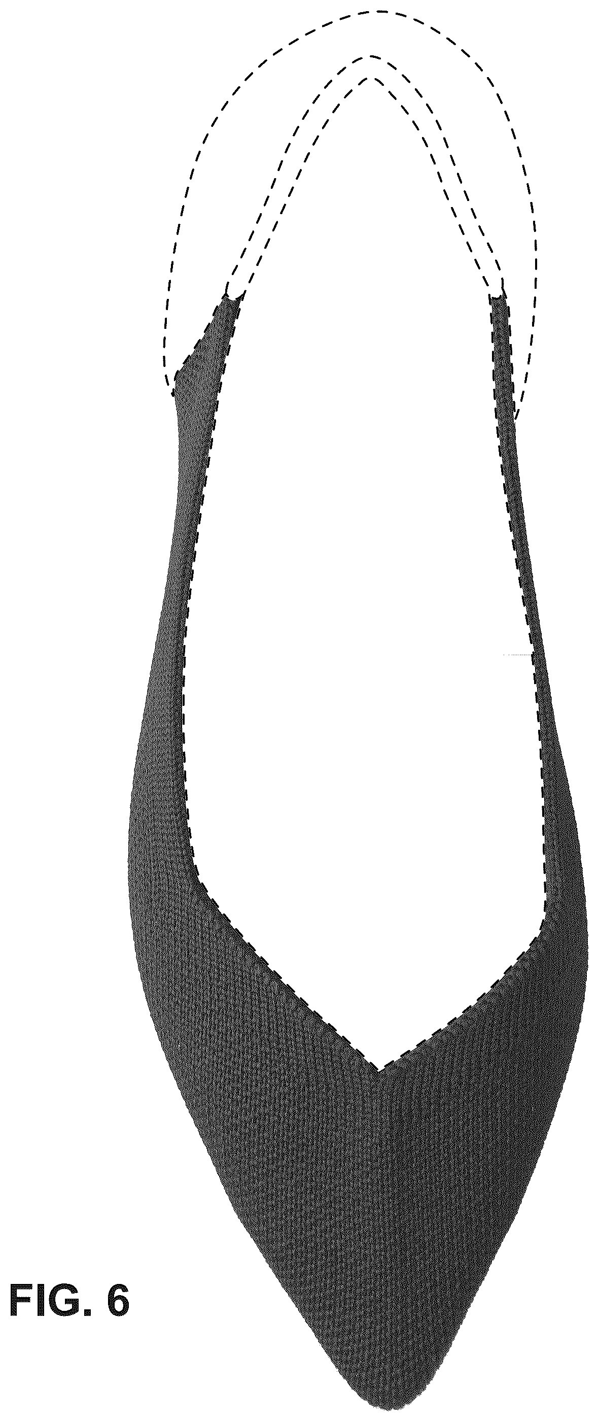 Patent USD1077428 Figure 5 – Shoe