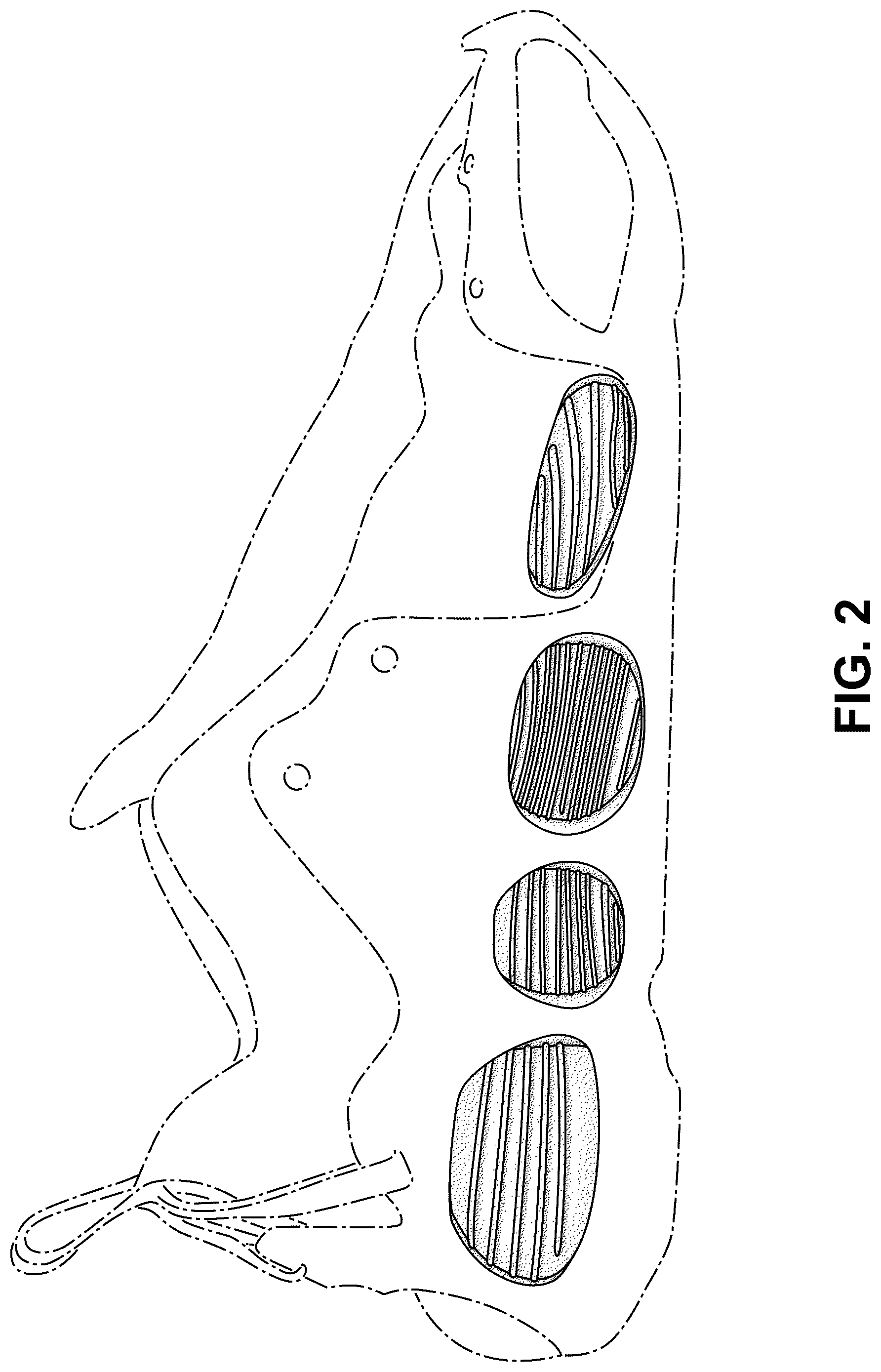 Patent USD1077433 Figure 2 – Shoe