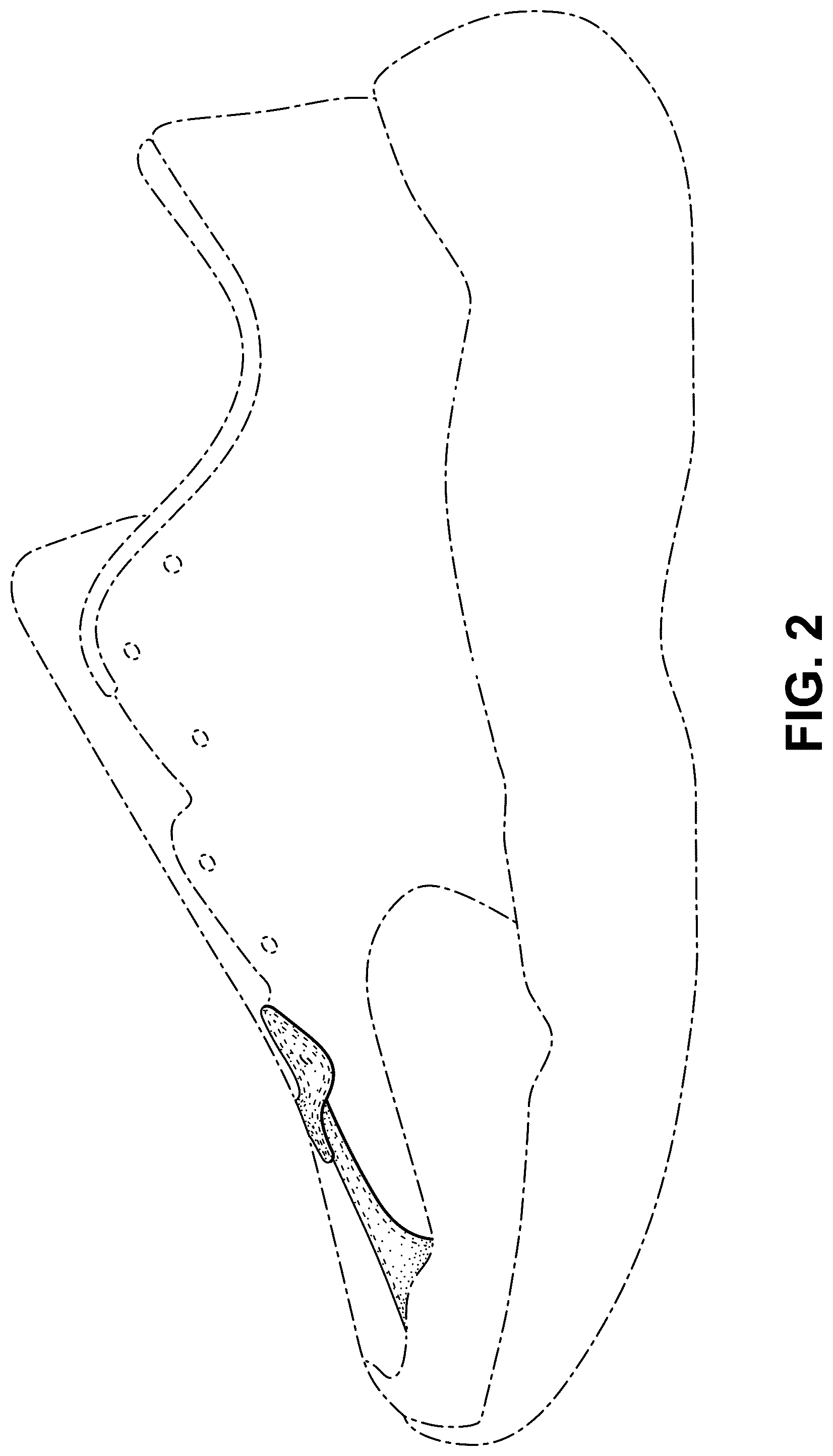 Patent USD1077450 Figure 2 – Shoe
