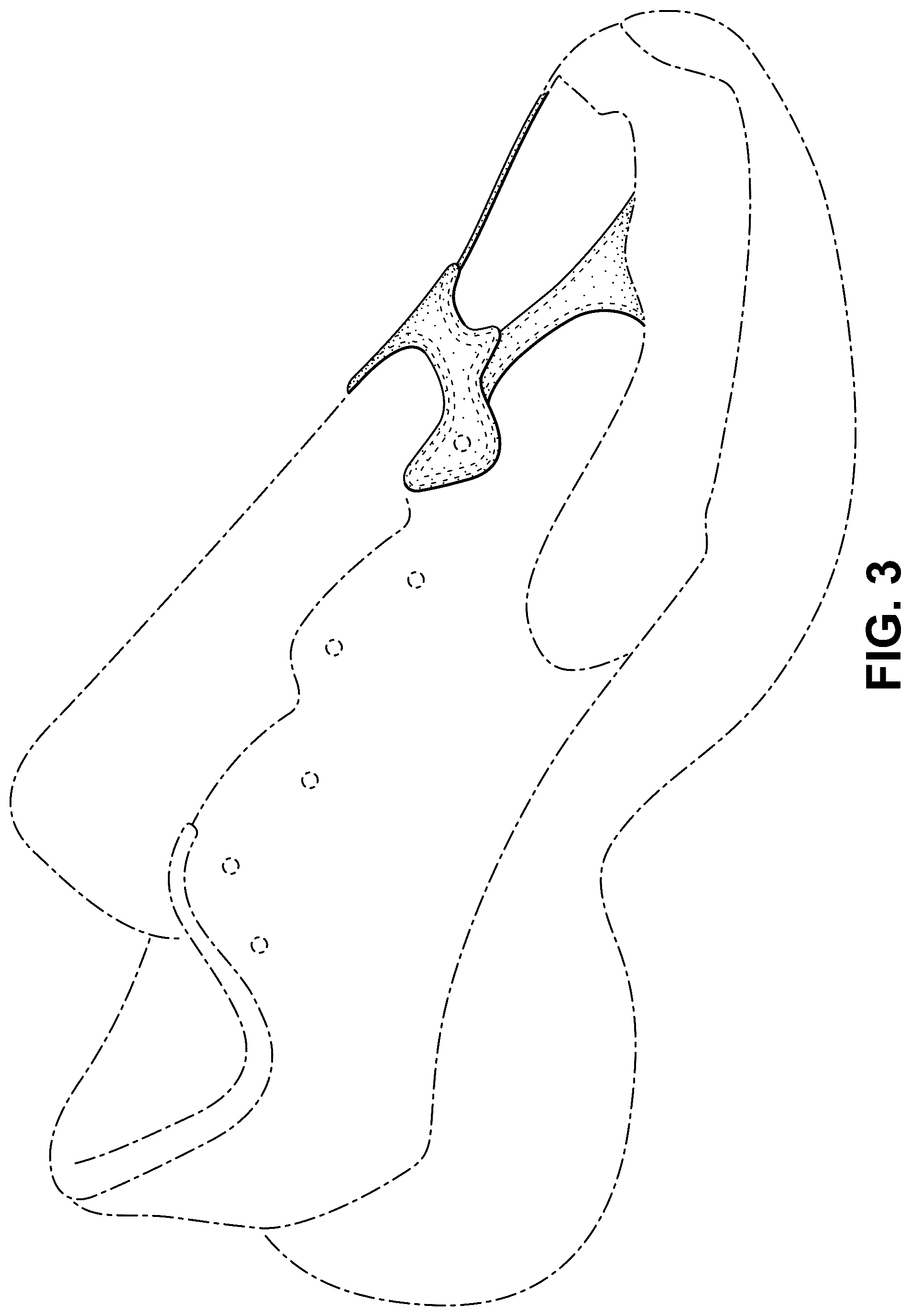 Patent USD1077450 Figure 3 – Shoe
