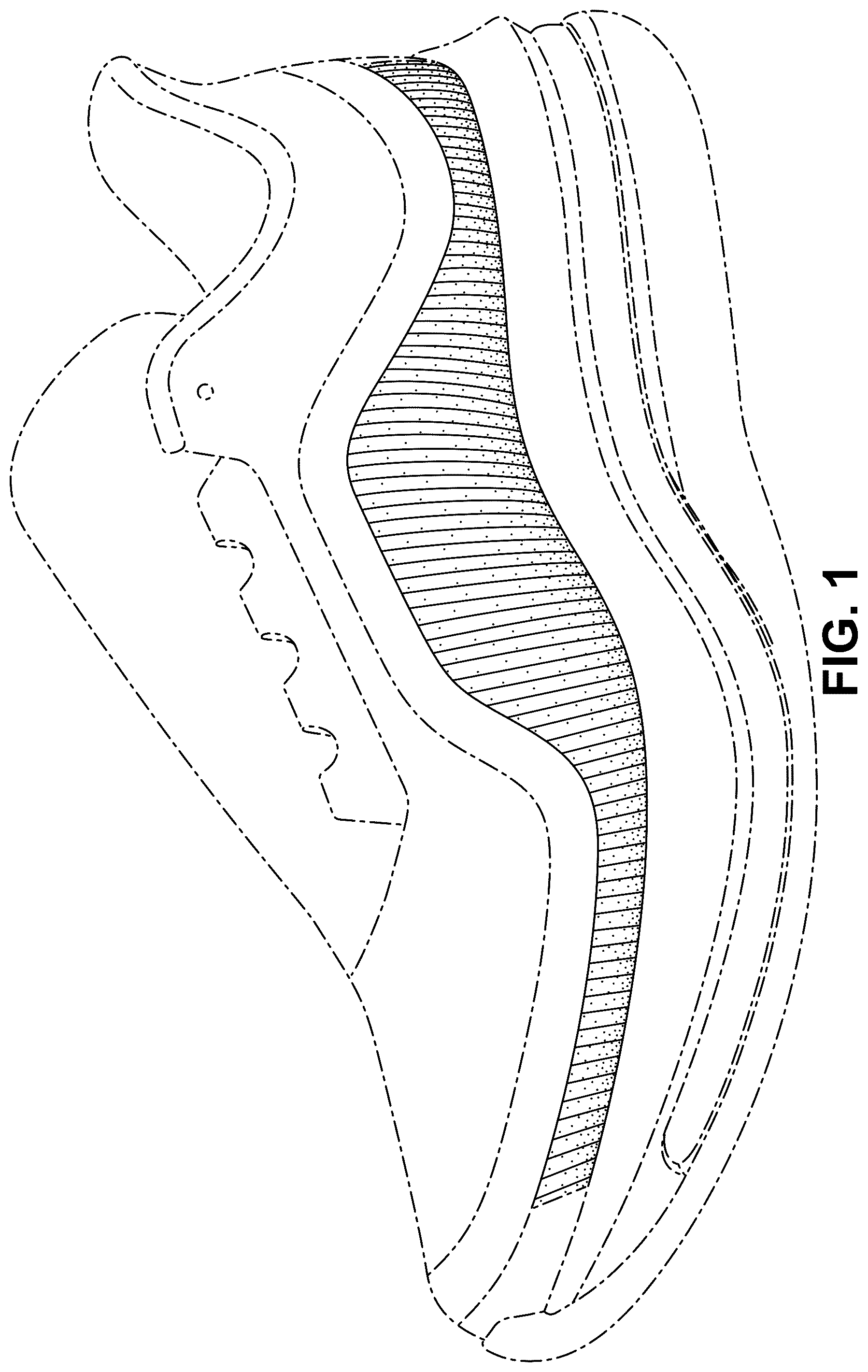 Patent USD1077451 Figure 1 – Shoe