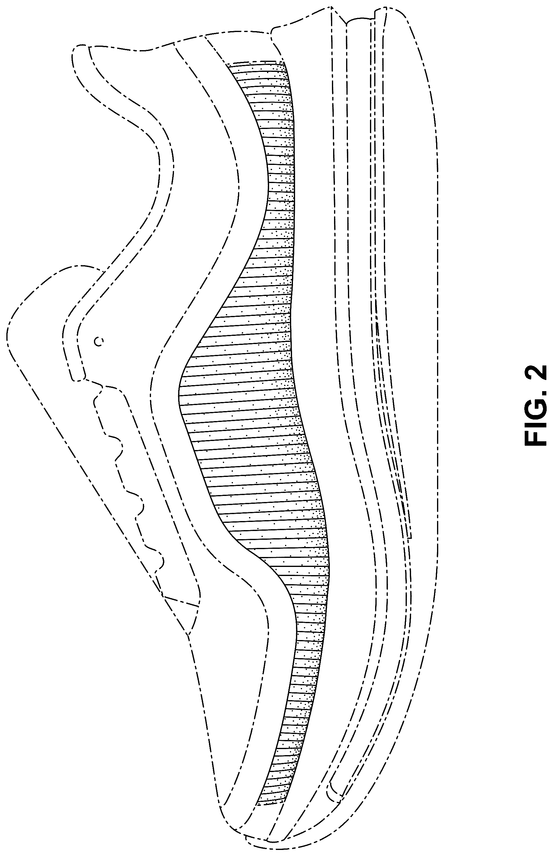 Patent USD1077451 Figure 2 – Shoe