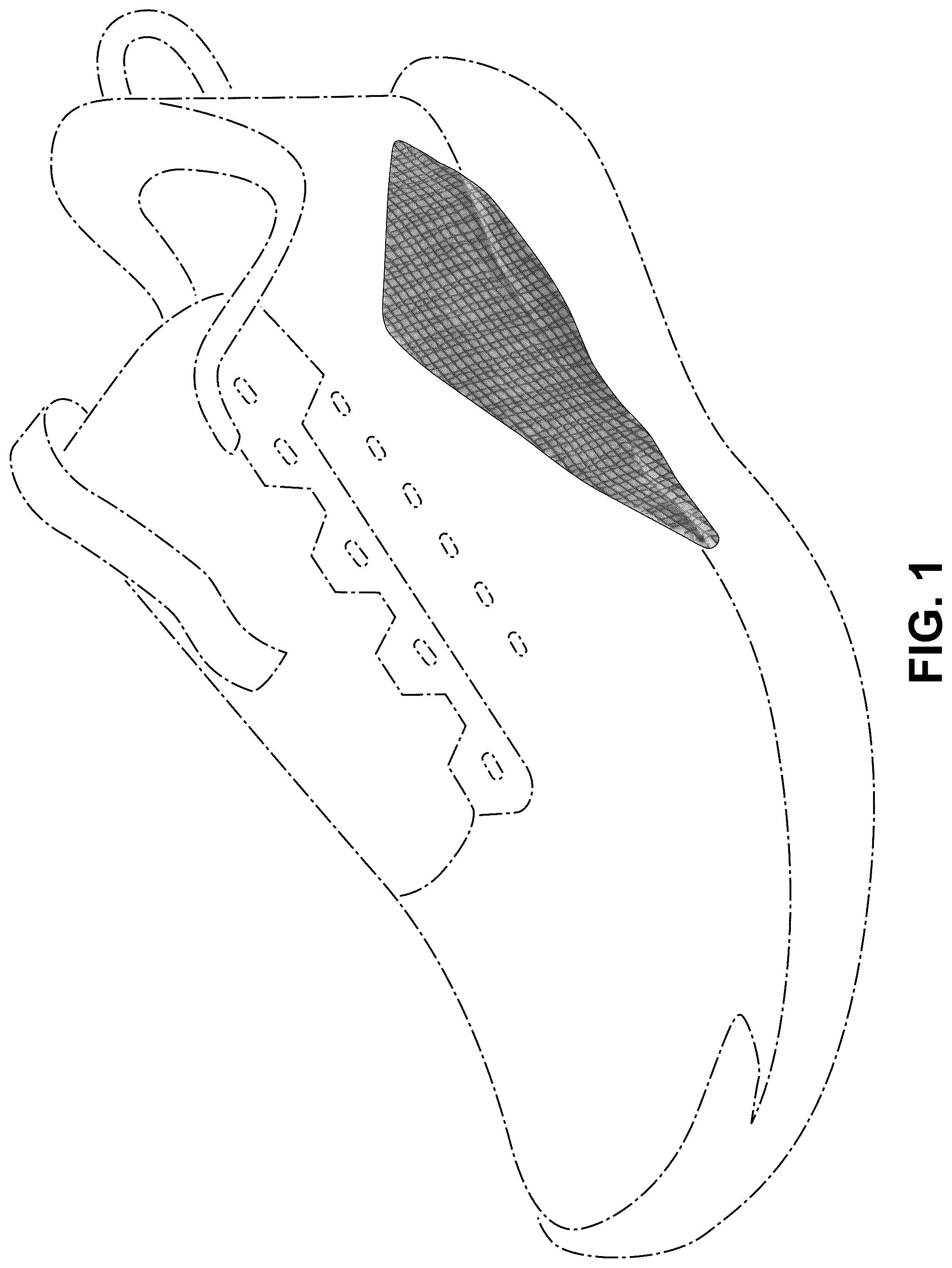 Patent USD1077454 Figure 1 – Shoe