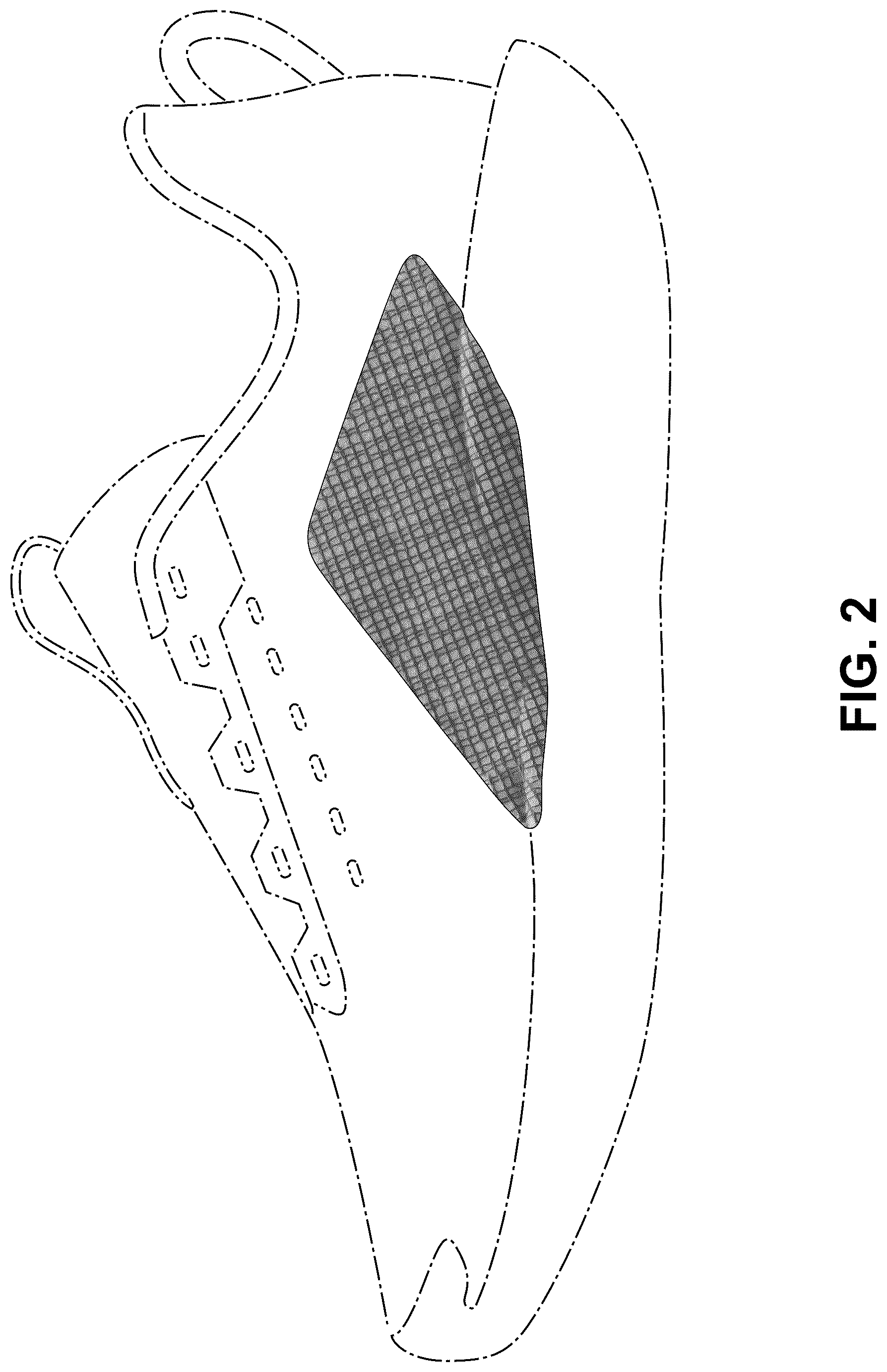 Patent USD1077454 Figure 2 – Shoe