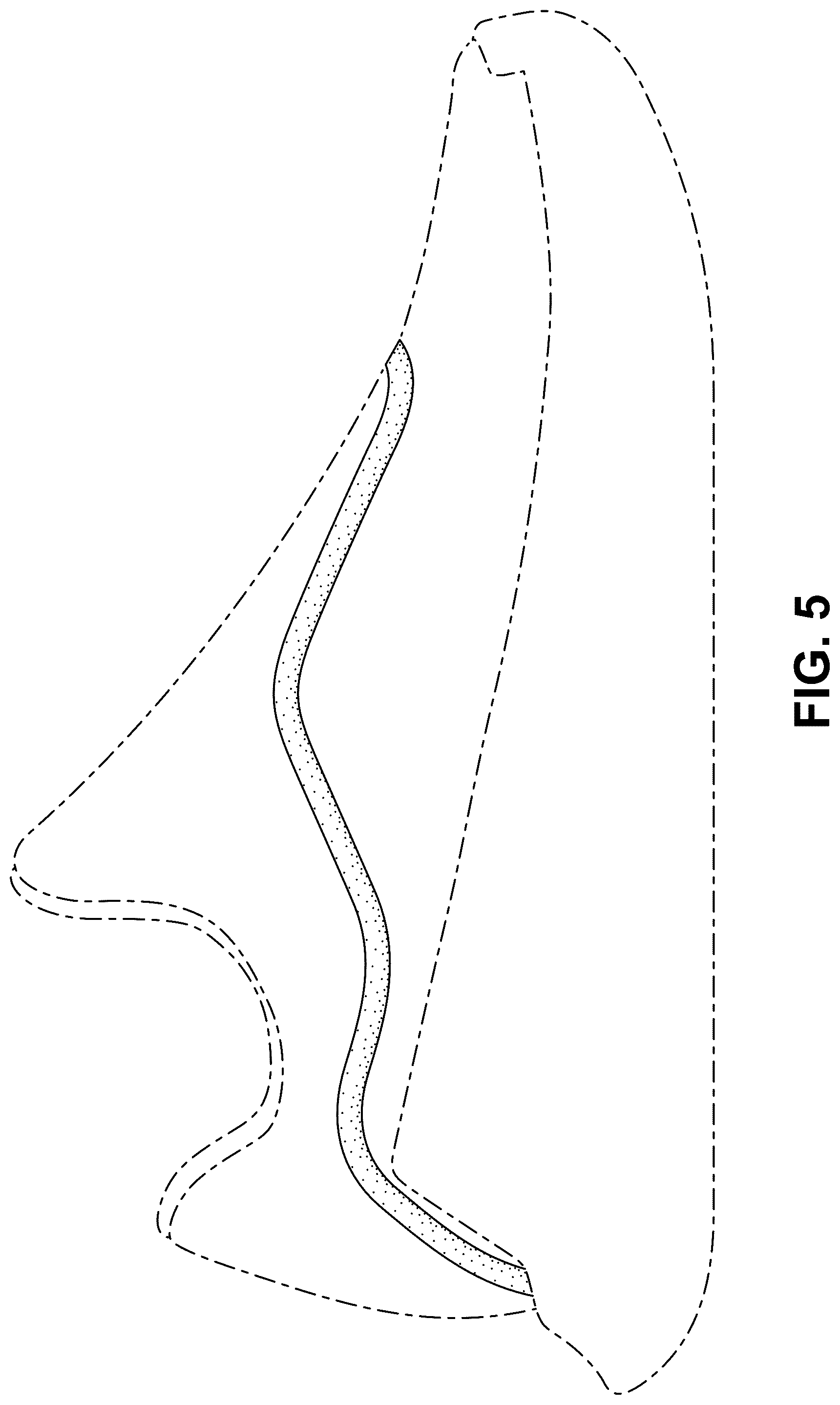 Patent USD1077456 Figure 5 – Shoe