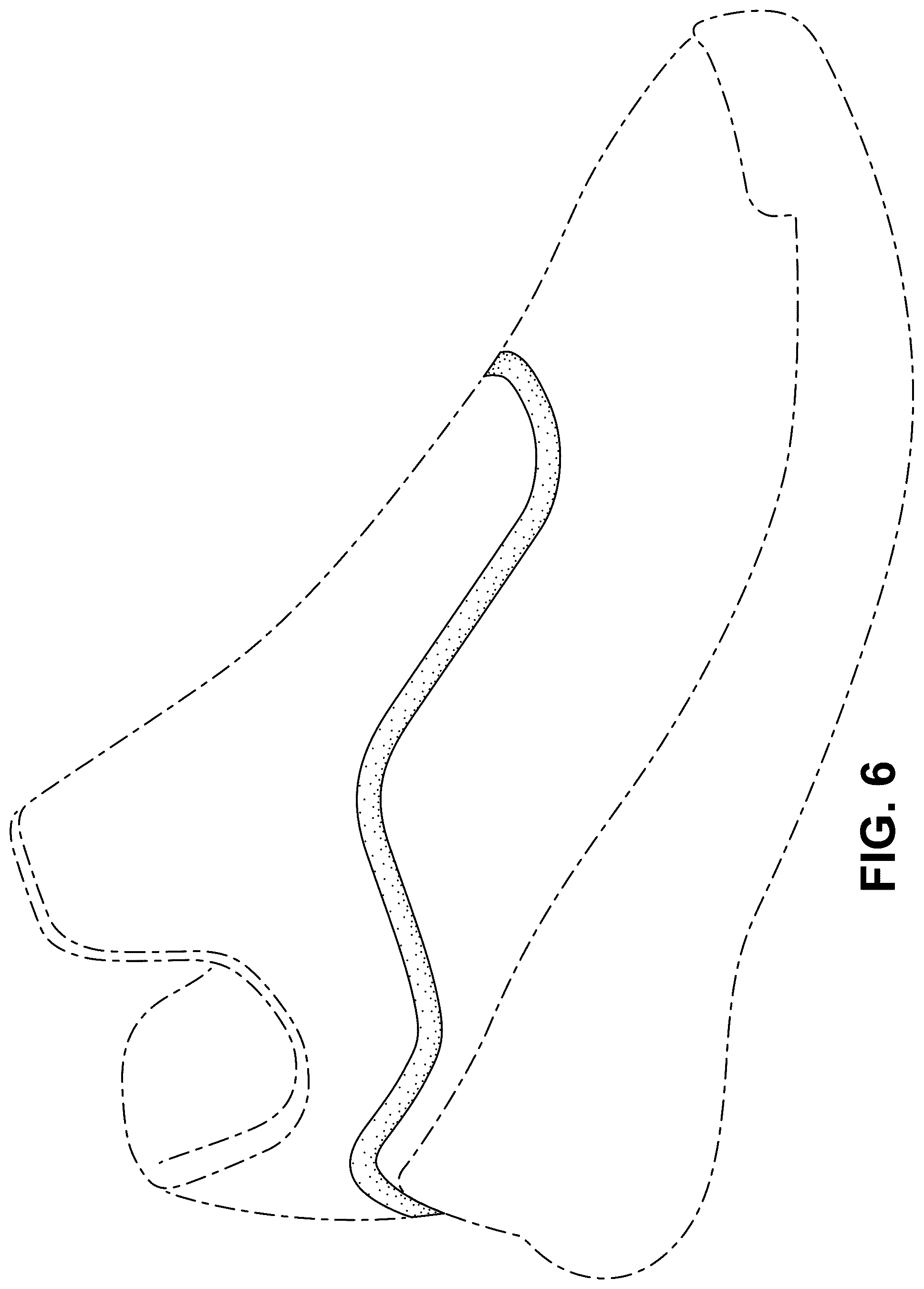 Patent USD1077456 Figure 6 – Shoe