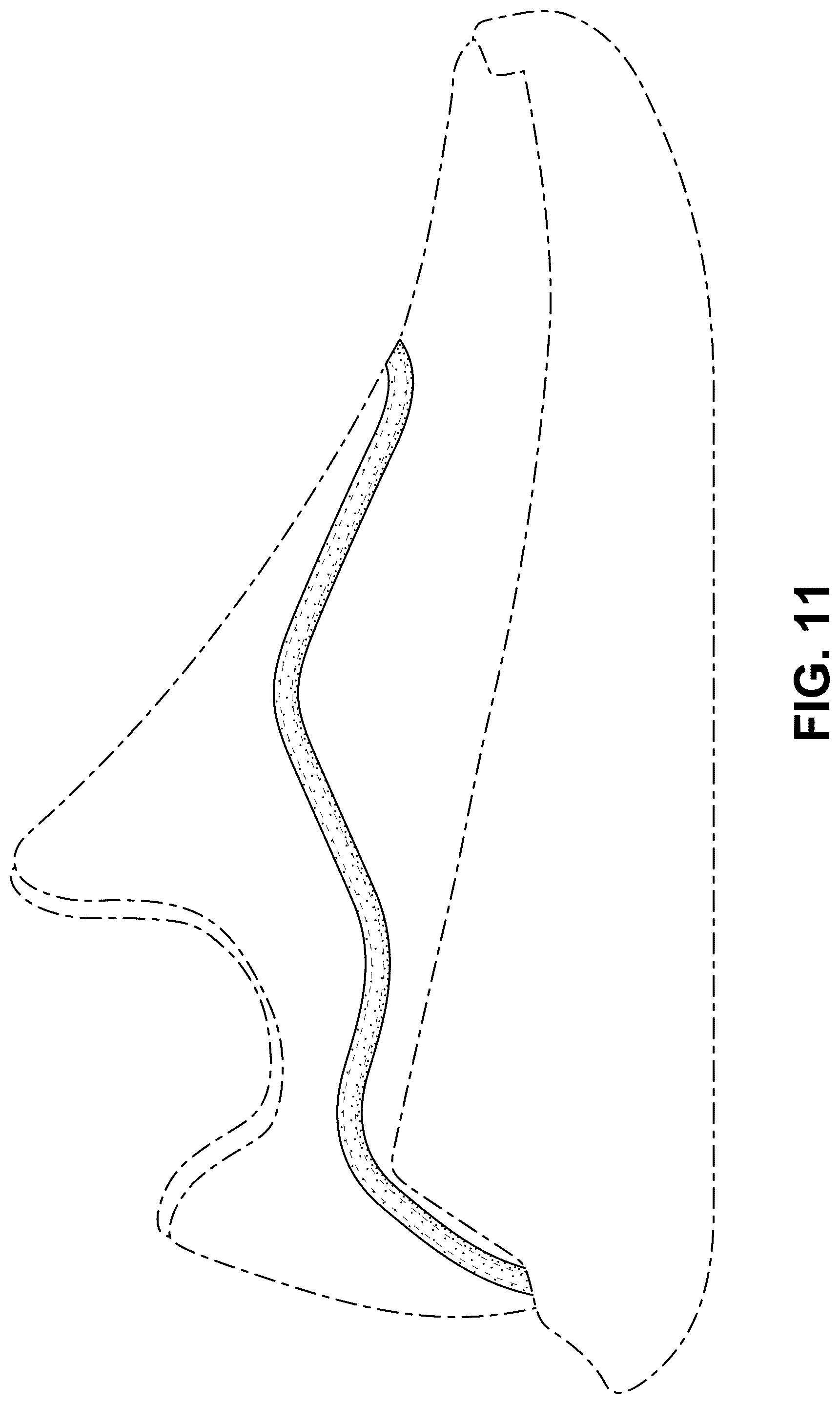 Patent USD1077456 Figure 11 – Shoe