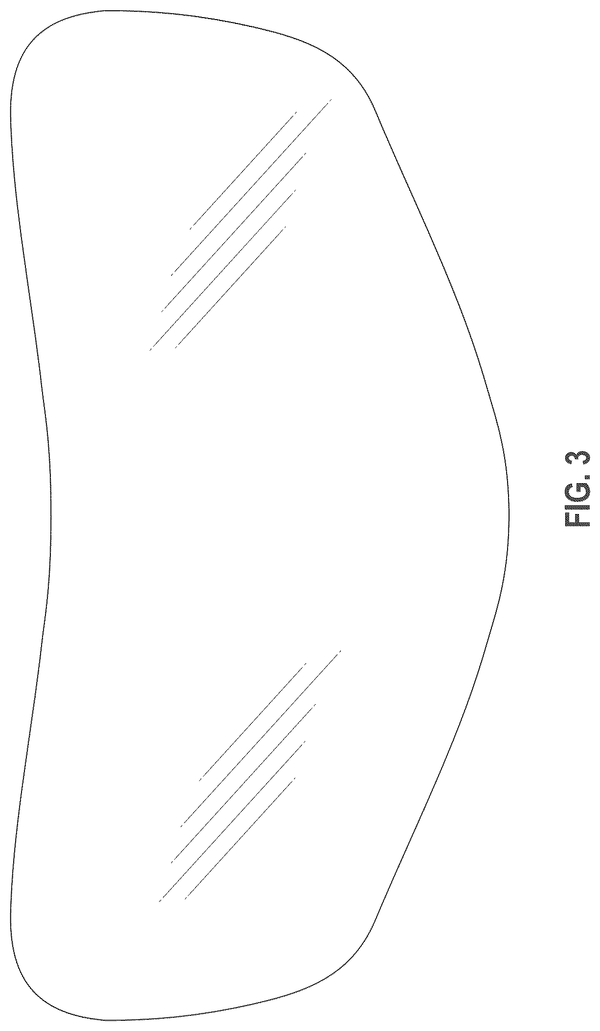 Patent USD1078064 Figure 3 – Tummy tuck device
