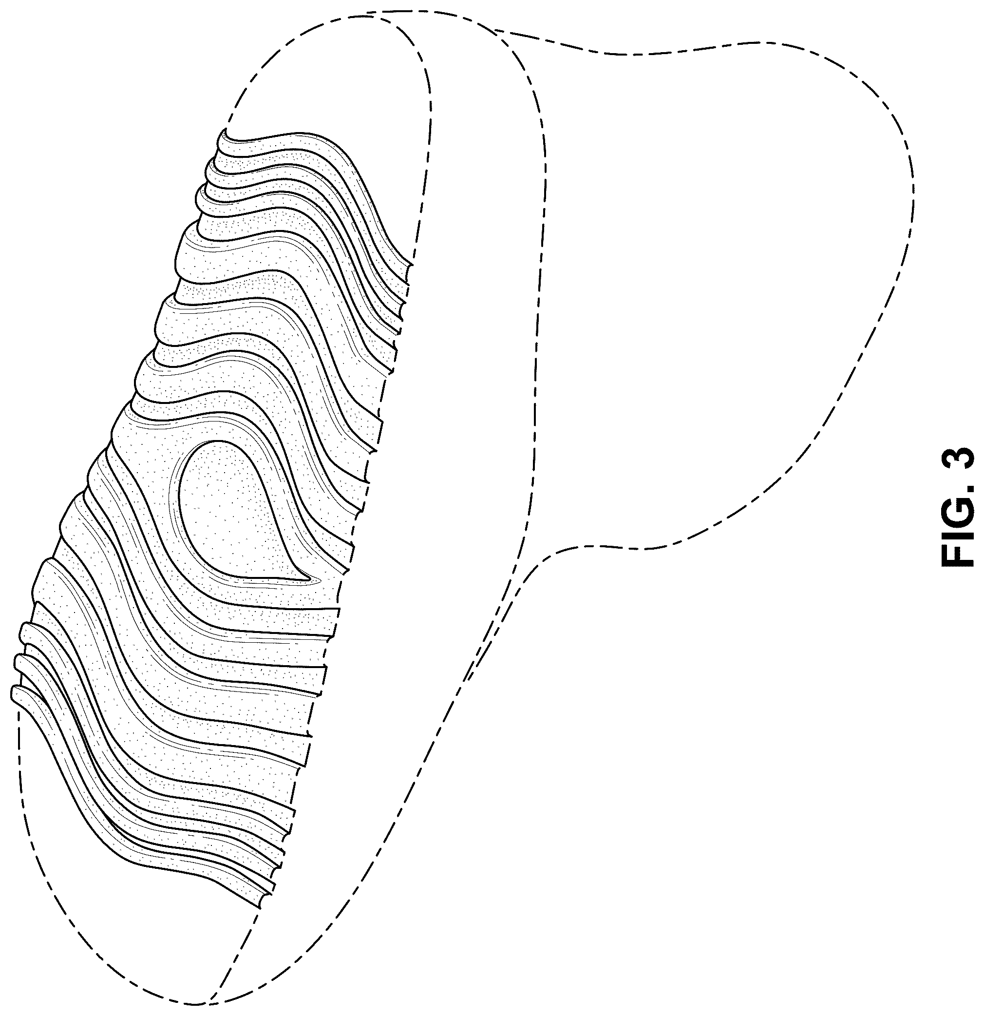 Patent USD1078243 Figure 3 – Shoe