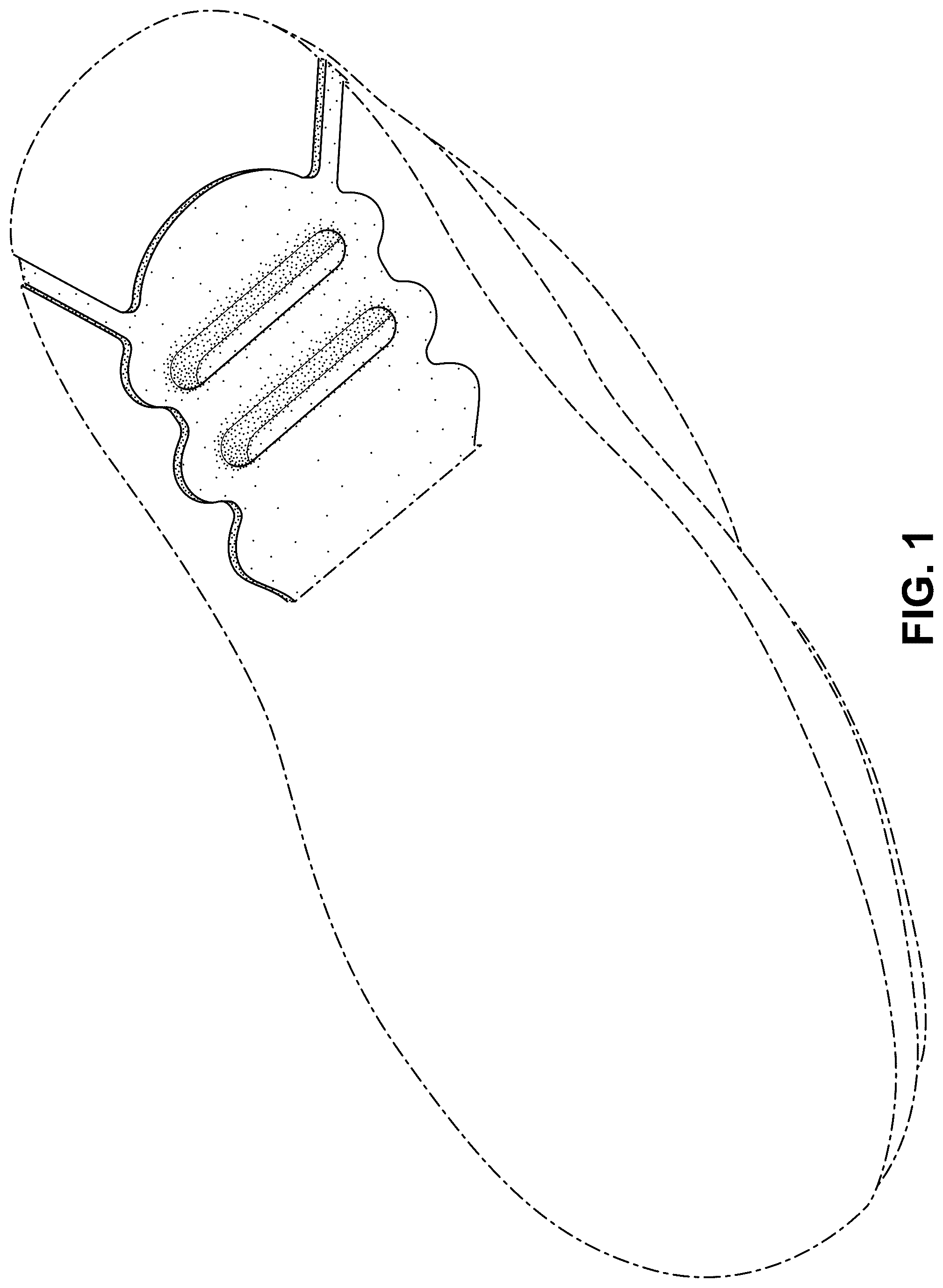Patent USD1078244 Figure 1 – Shoe