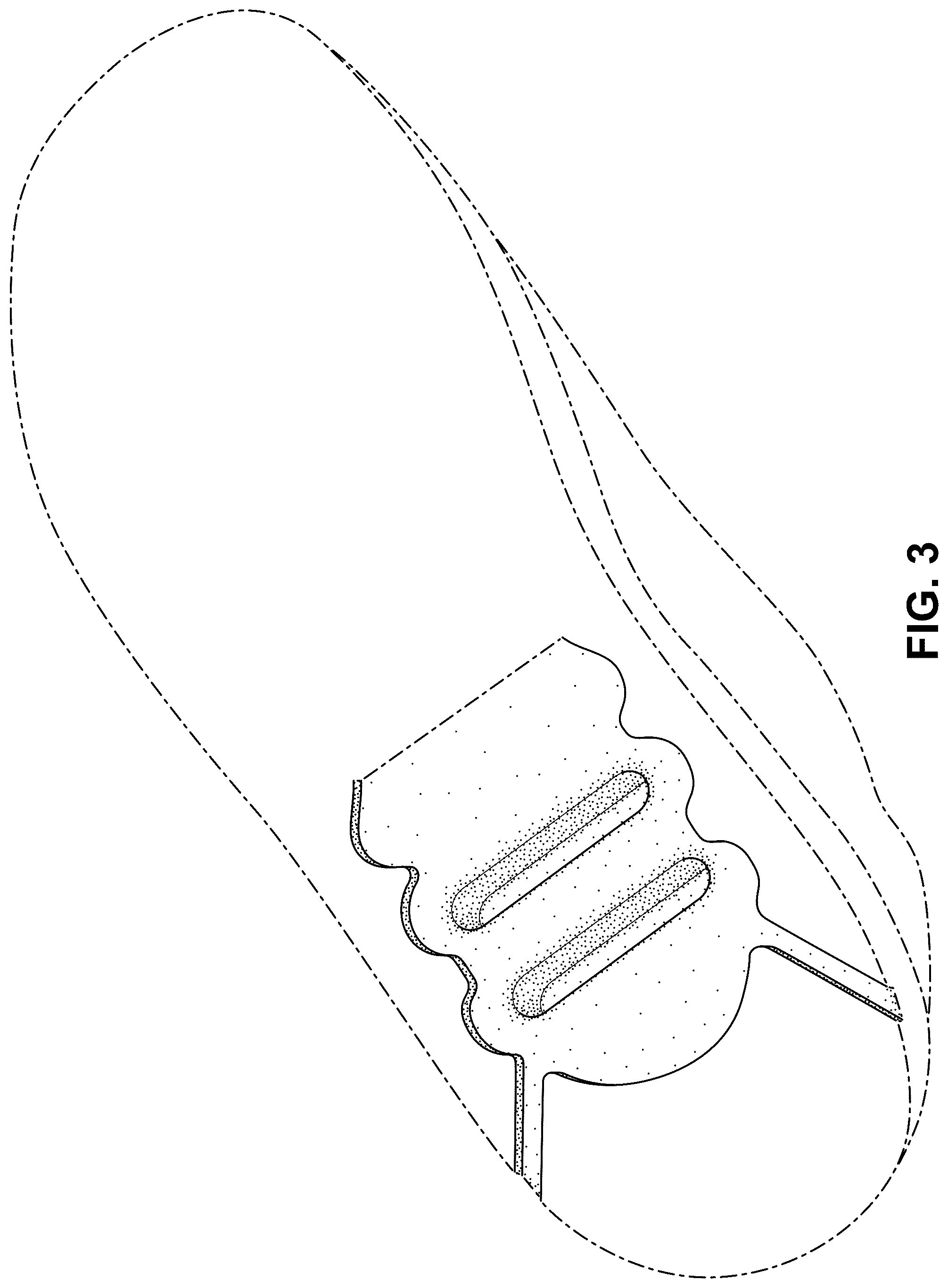 Patent USD1078244 Figure 3 – Shoe
