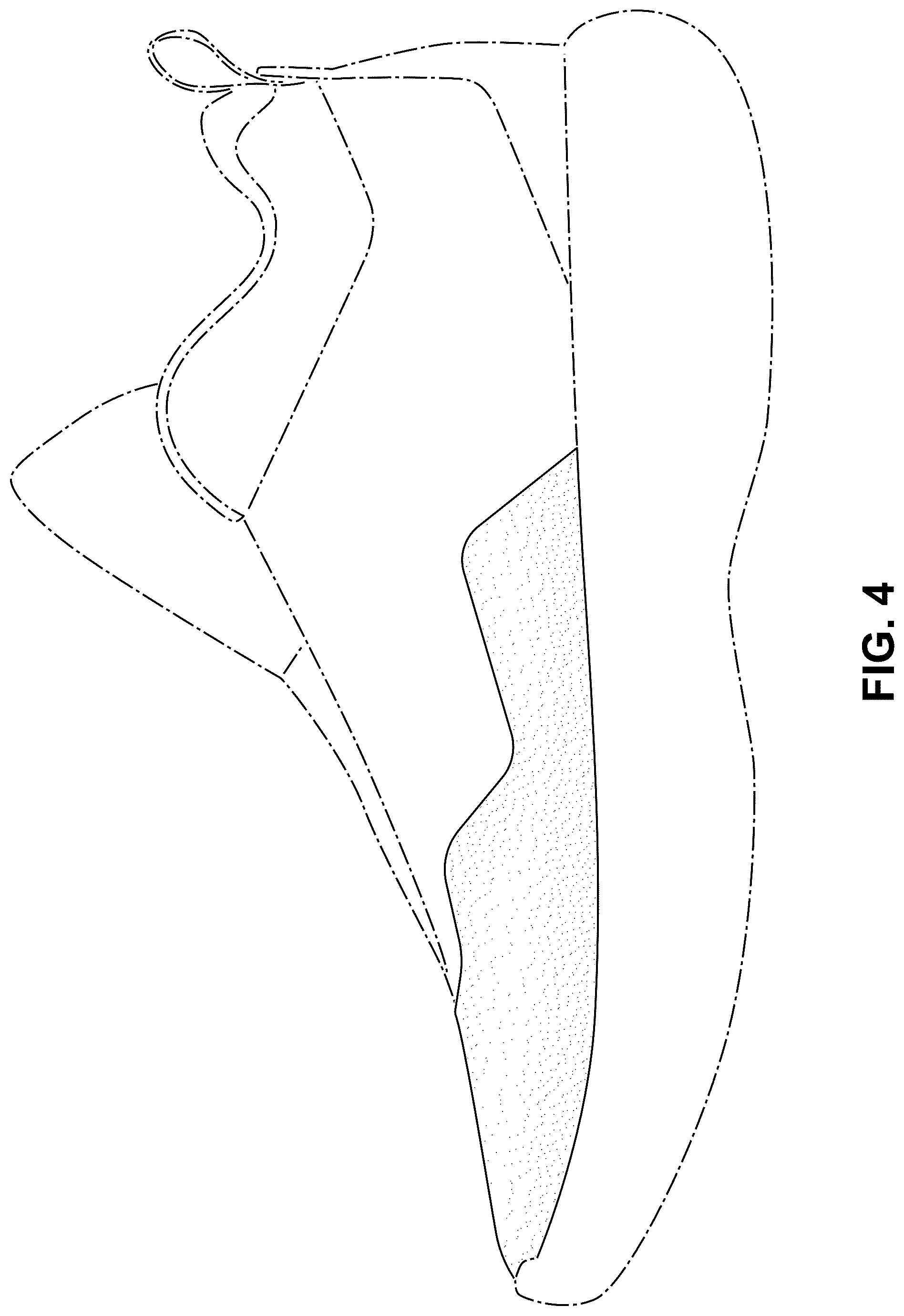 Patent USD1078253 Figure 4 – Shoe