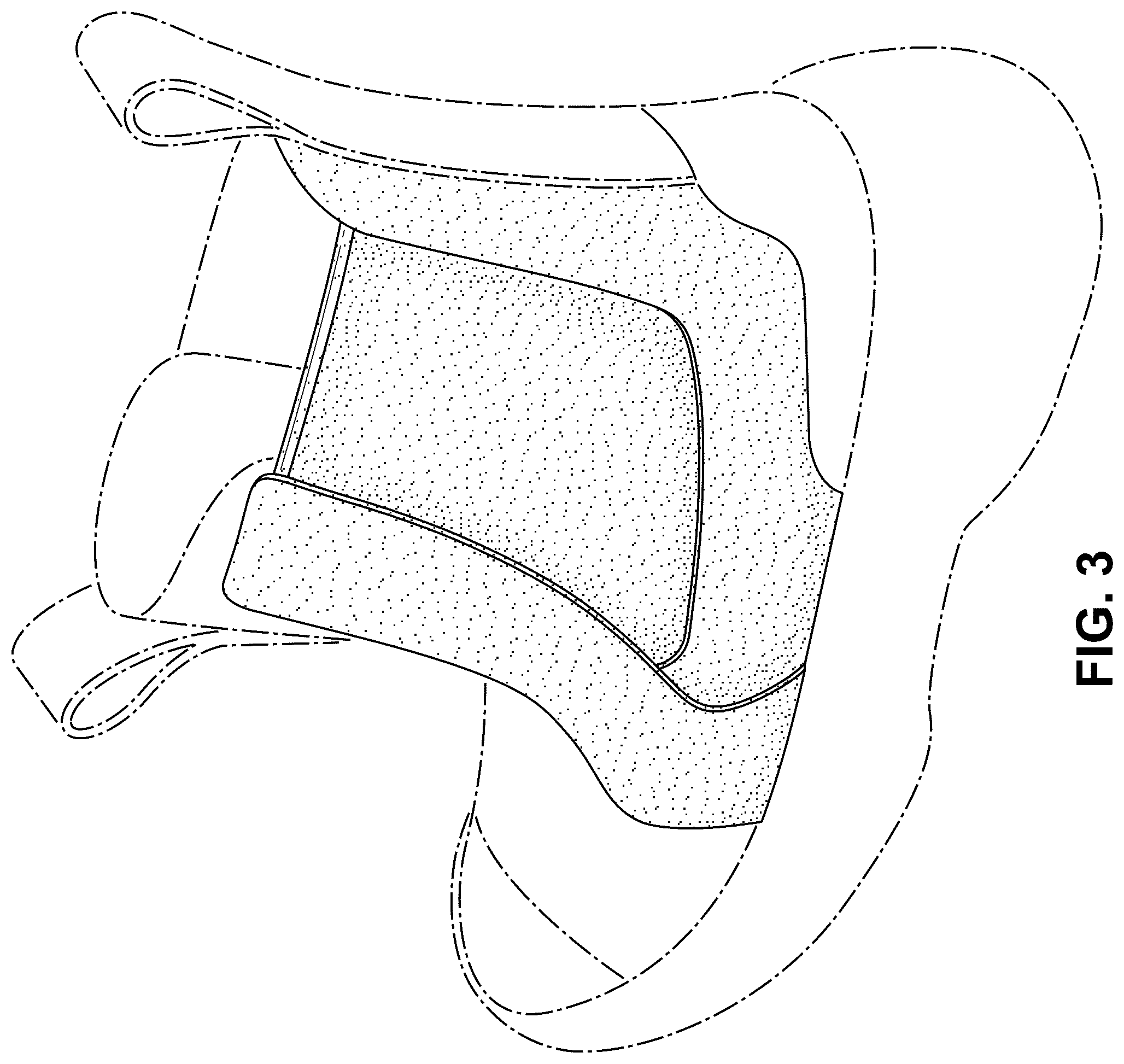 Patent USD1078254 Figure 3 – Shoe