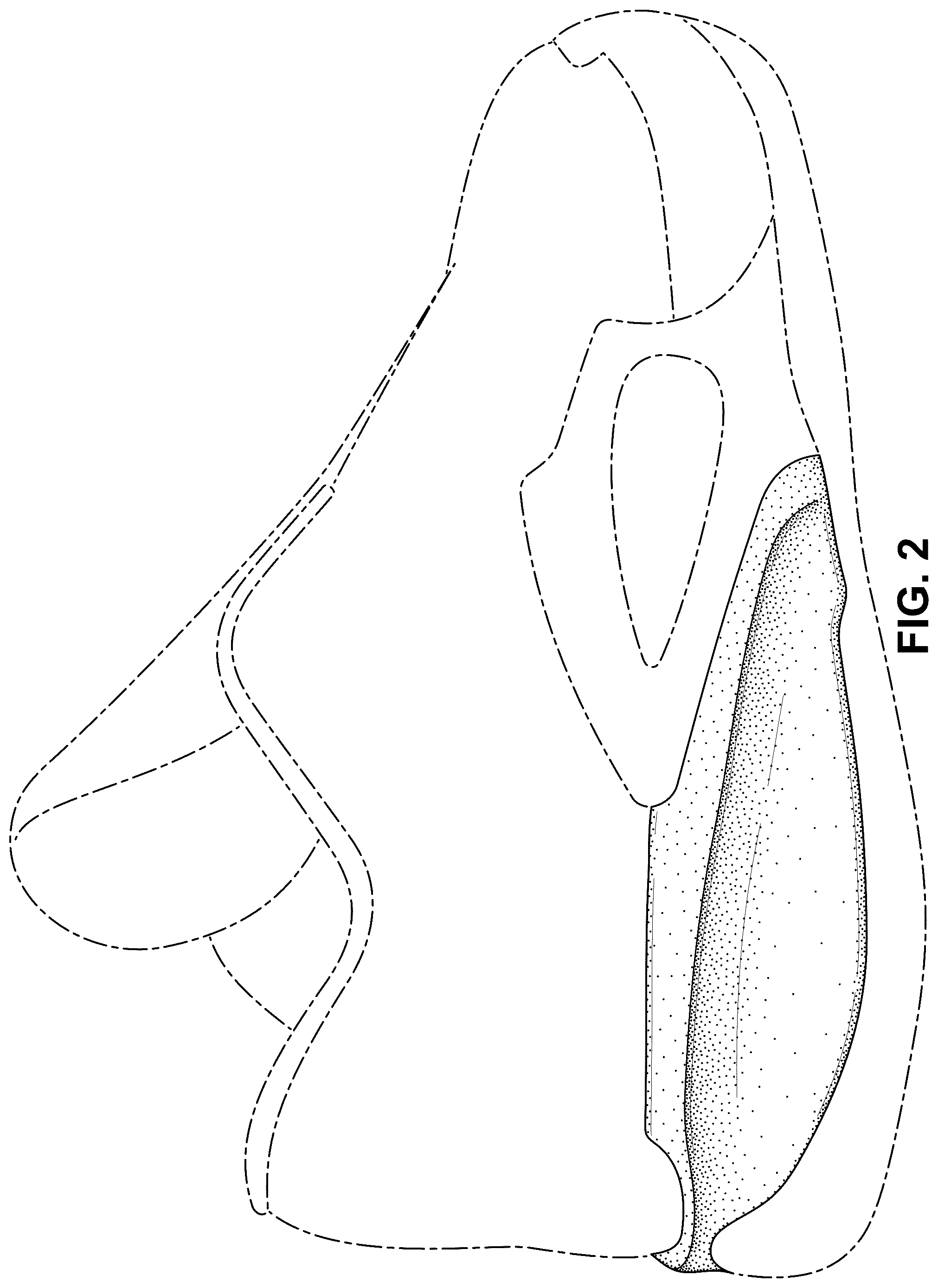 Patent USD1100453 Figure 2 – Shoe