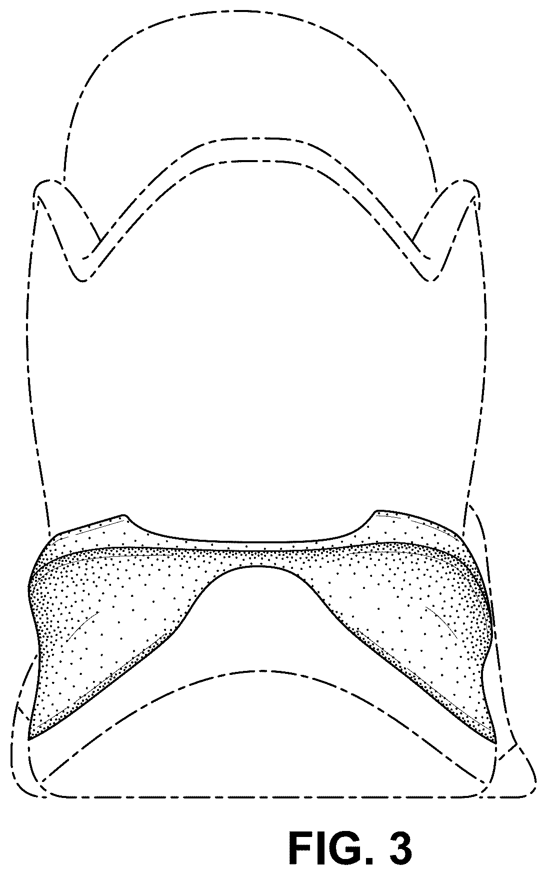 Patent USD1100453 Figure 3 – Shoe