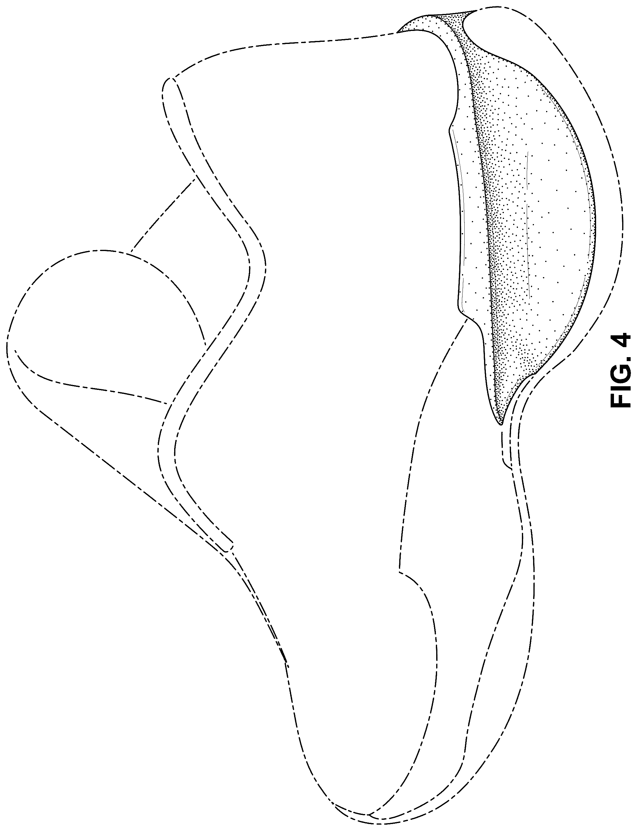 Patent USD1100453 Figure 4 – Shoe