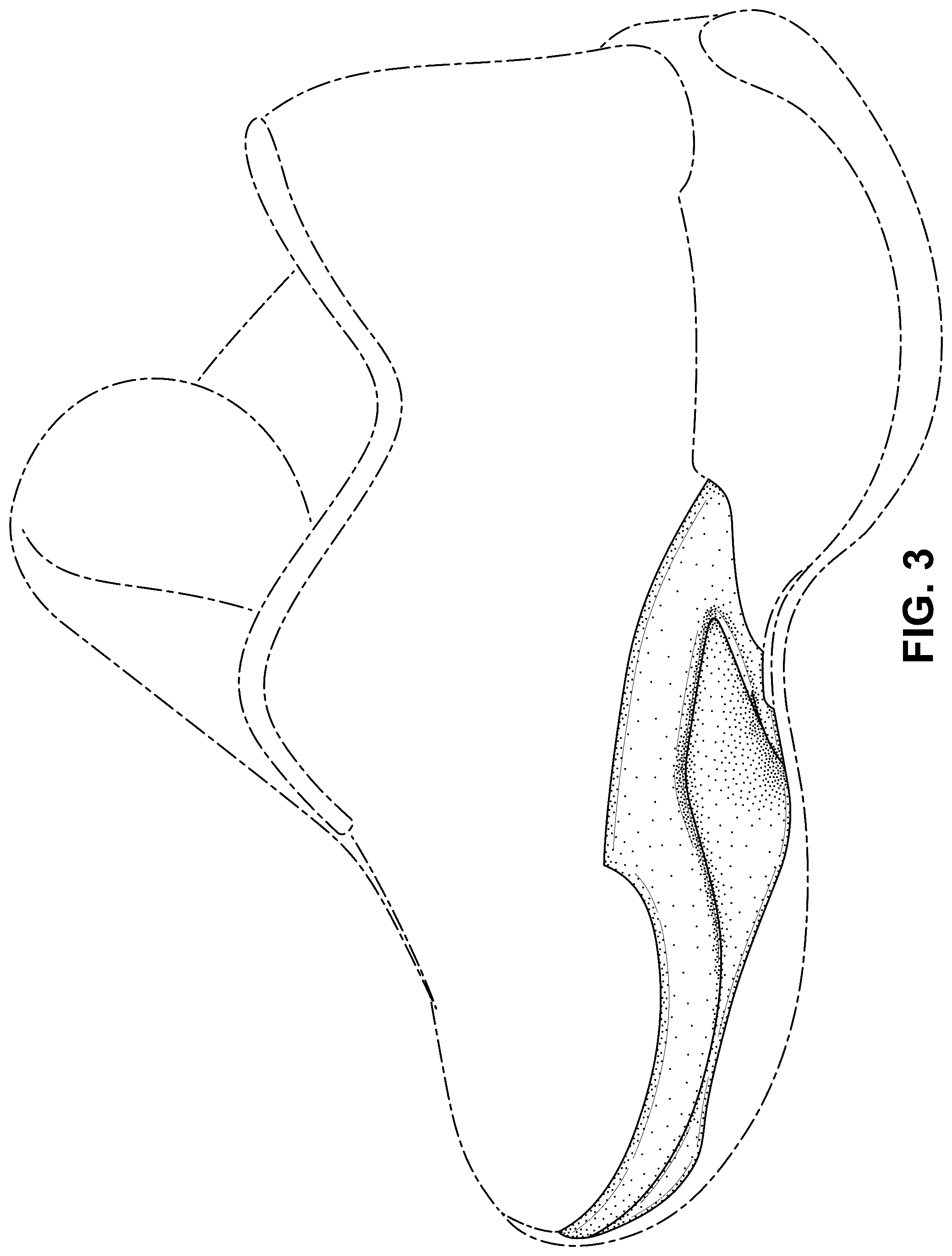 Patent USD1100454 Figure 3 – Shoe