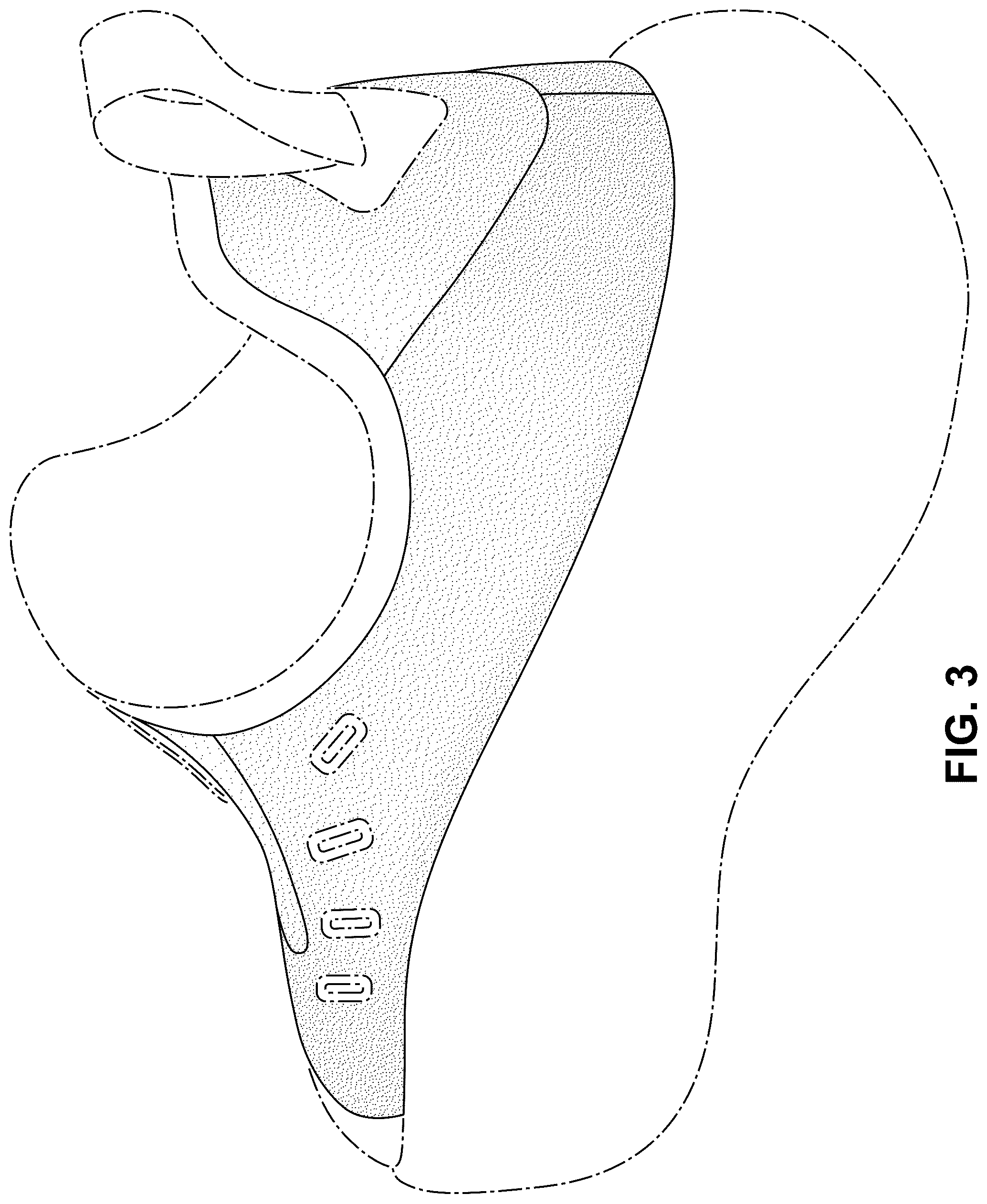 Patent USD1100467 Figure 3 – Shoe