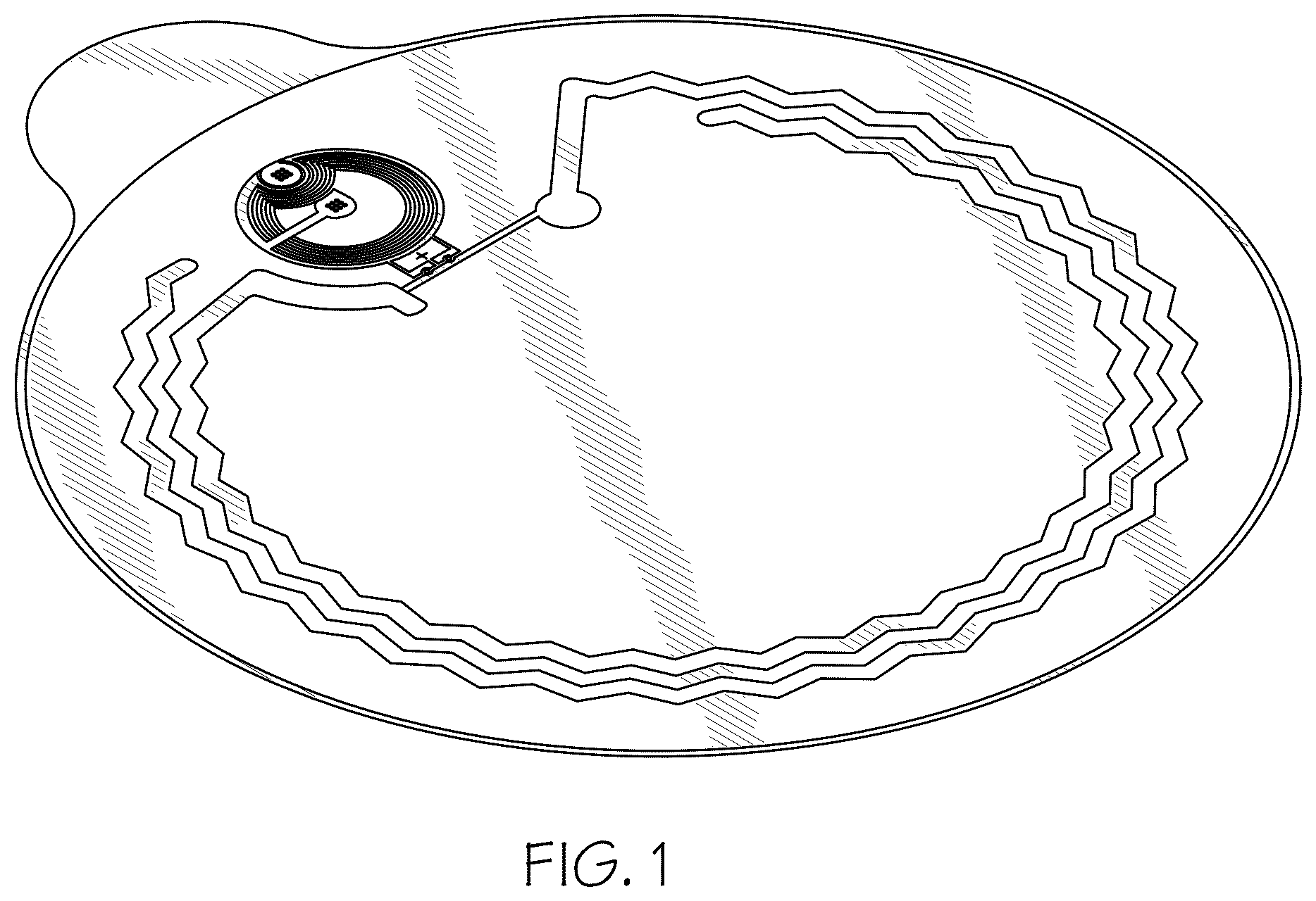 Patent USD1101142 Figure 1 – Ostomy flange with leakage detecting sensors