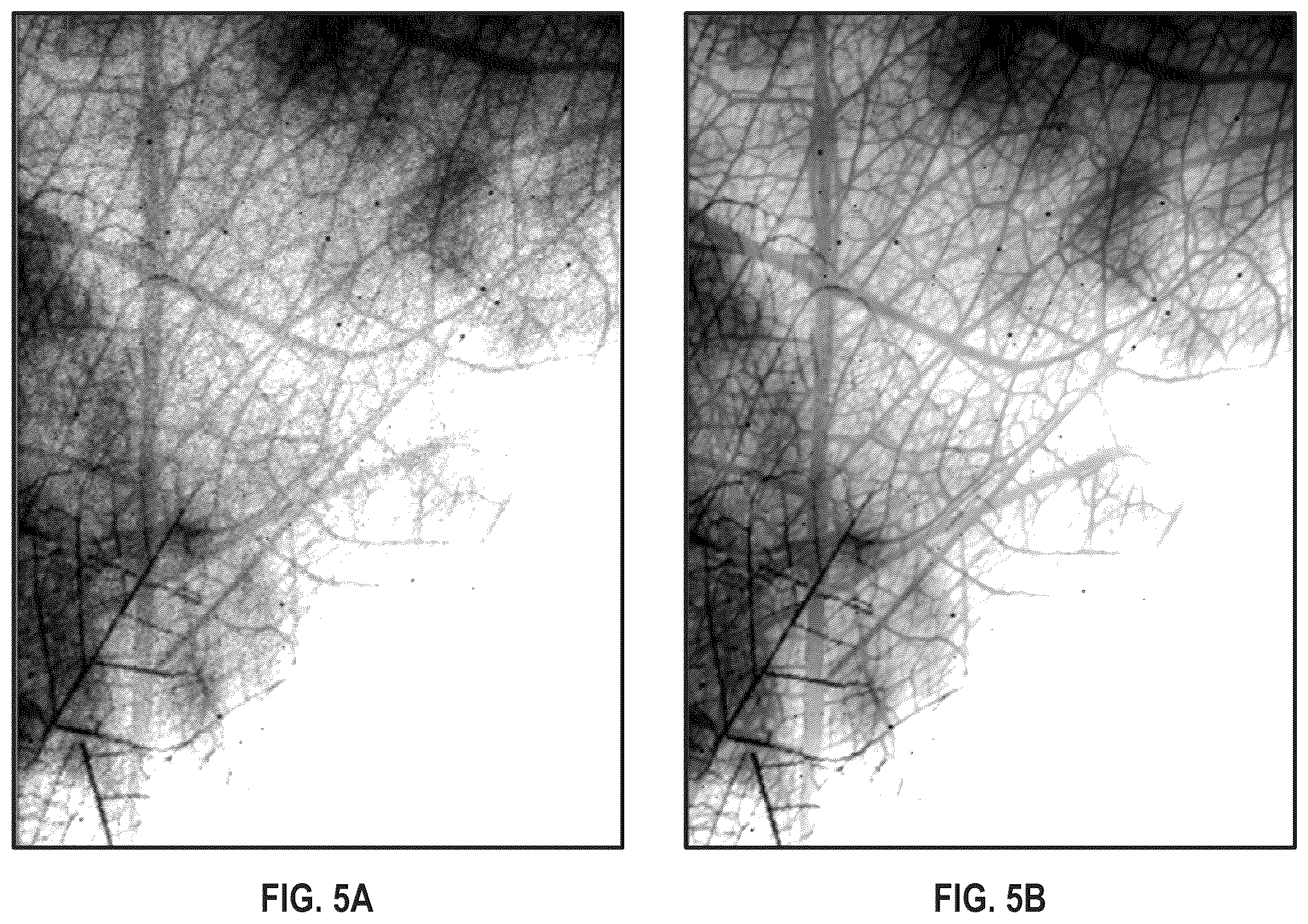 Patent US12541823 Figure 5 – Method of generating training data and medical image processing apparatus for deep-learning-based mammography denoising