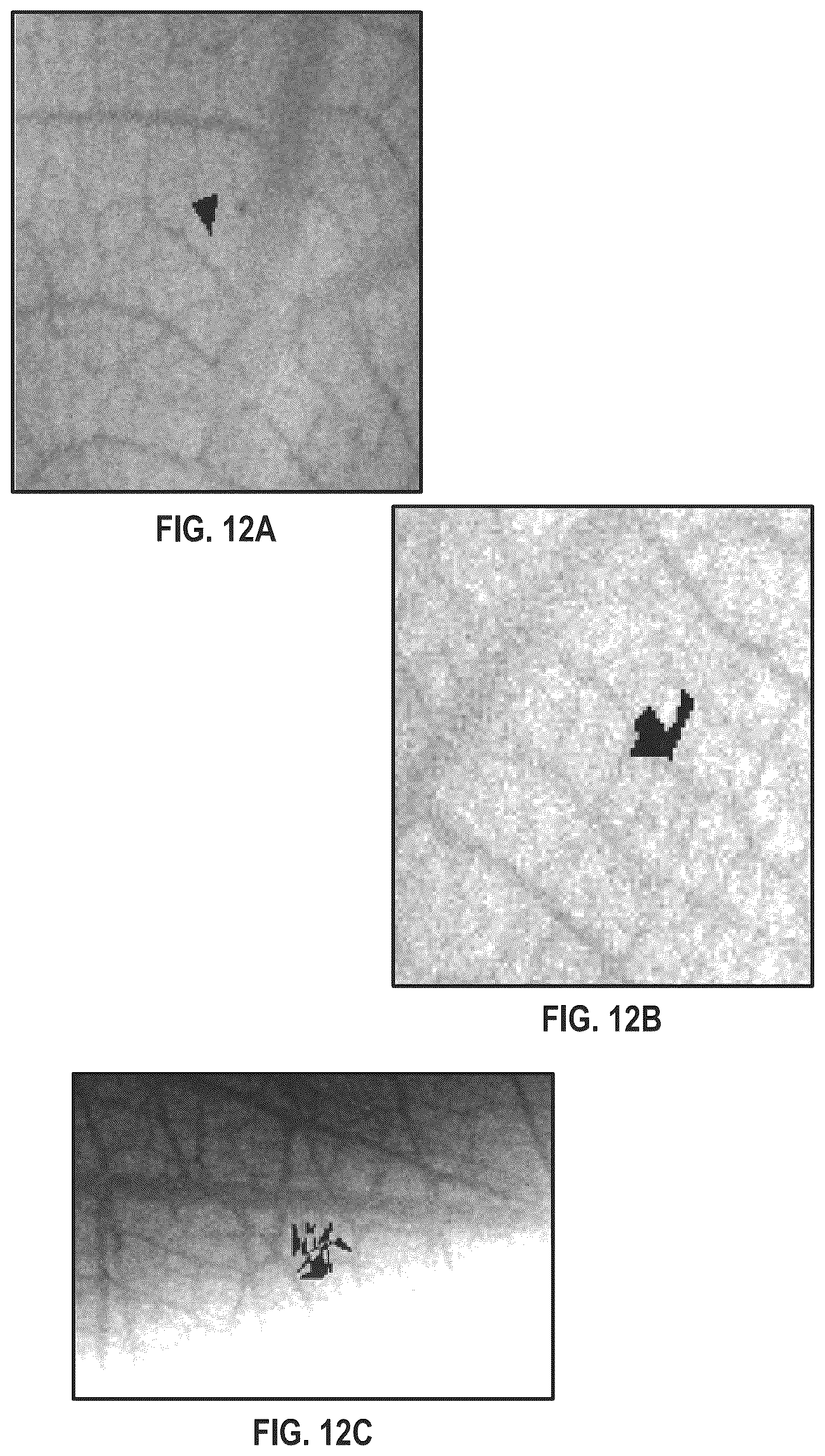 Patent US12541823 Figure 10 – Method of generating training data and medical image processing apparatus for deep-learning-based mammography denoising