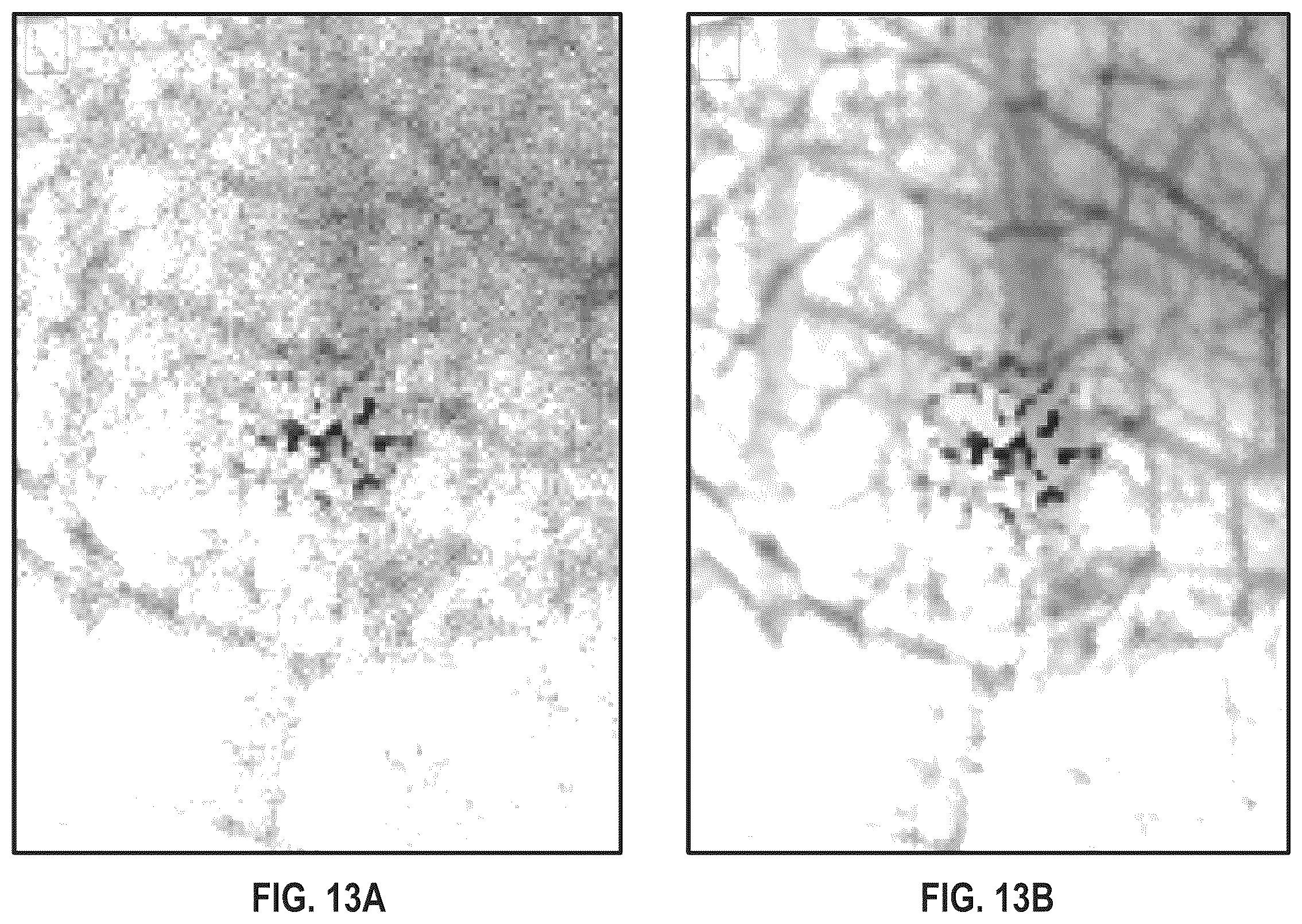Patent US12541823 Figure 11 – Method of generating training data and medical image processing apparatus for deep-learning-based mammography denoising