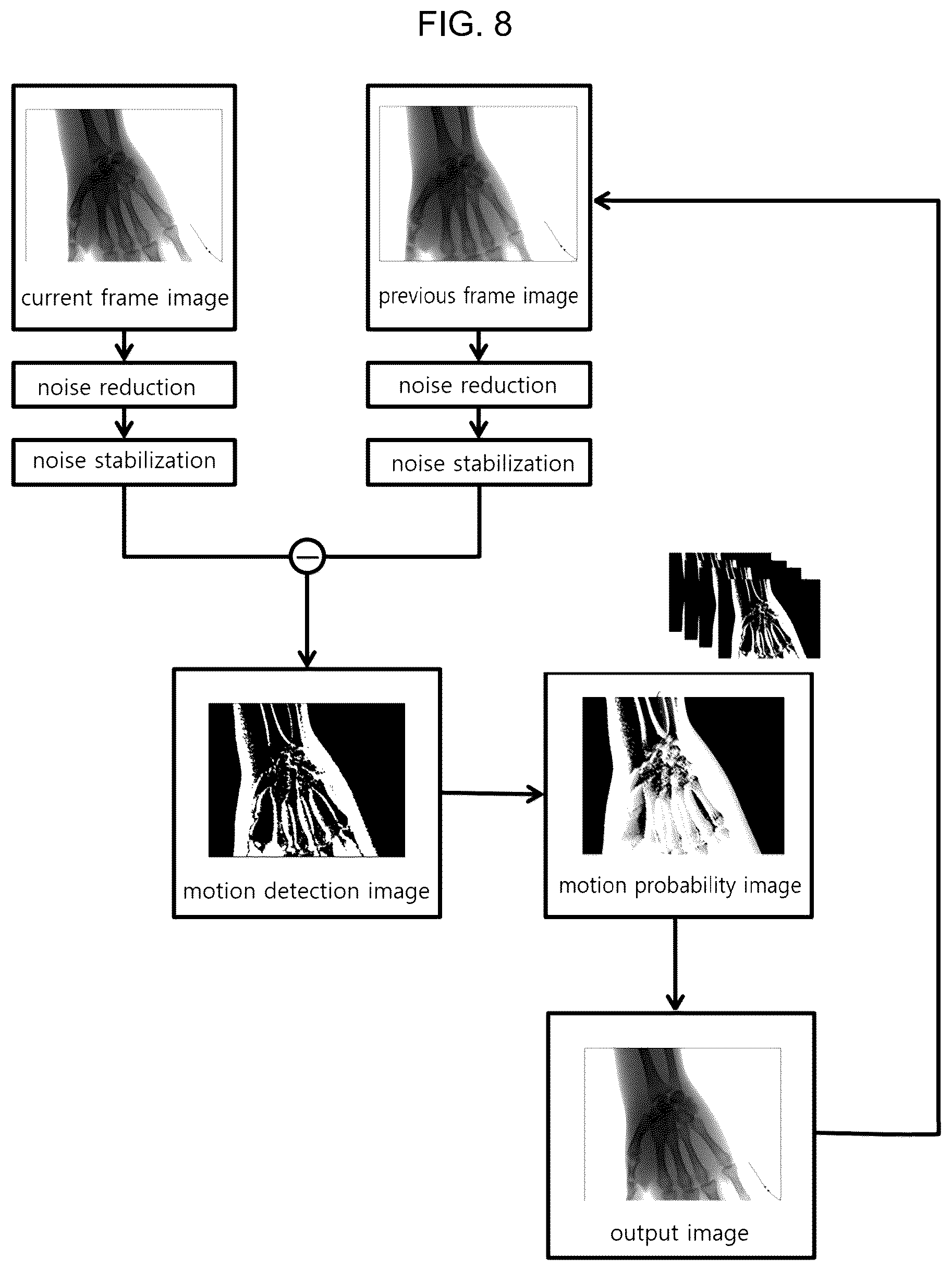Patent US12541824 Figure 7 – Image processing method and apparatus for reducing noise of image obtained by radiography