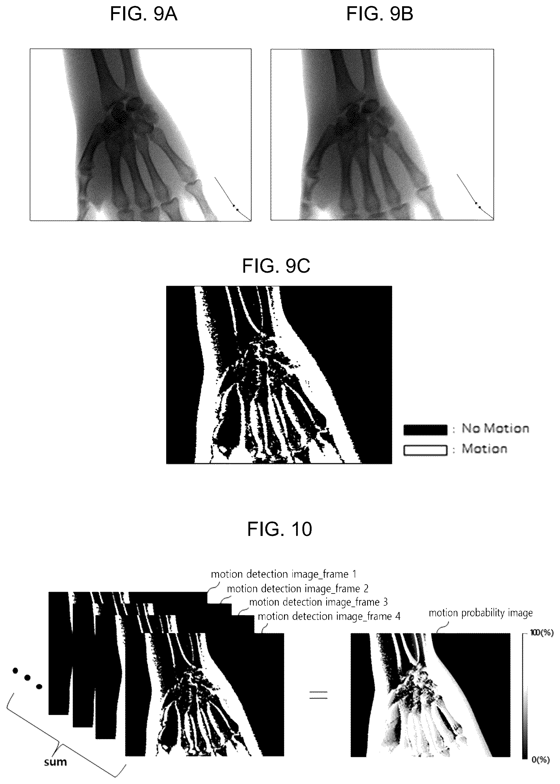 Patent US12541824 Figure 8 – Image processing method and apparatus for reducing noise of image obtained by radiography