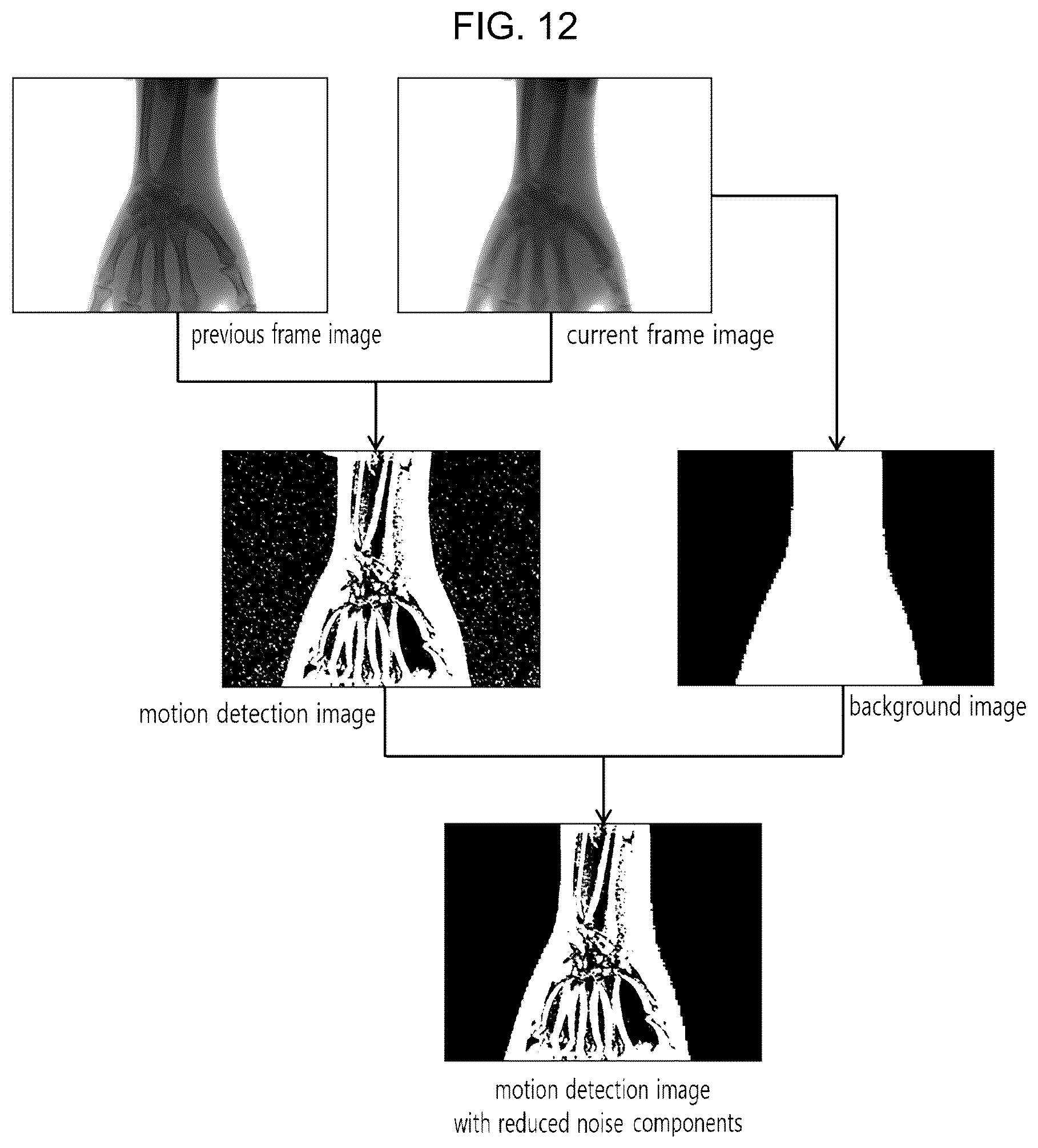 Patent US12541824 Figure 10 – Image processing method and apparatus for reducing noise of image obtained by radiography