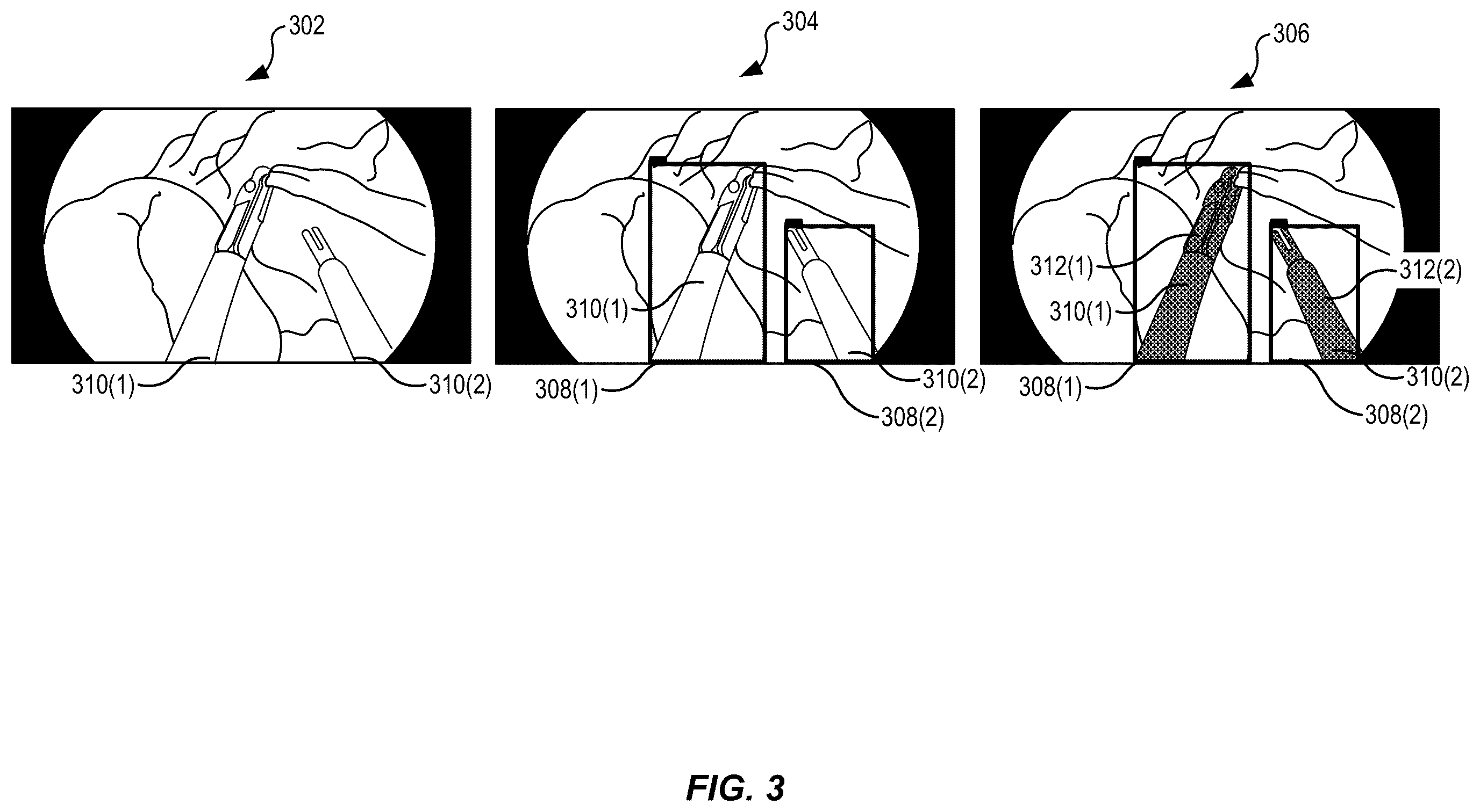 Patent US12541854 Figure 3 – Segmentation generation for image-related functions