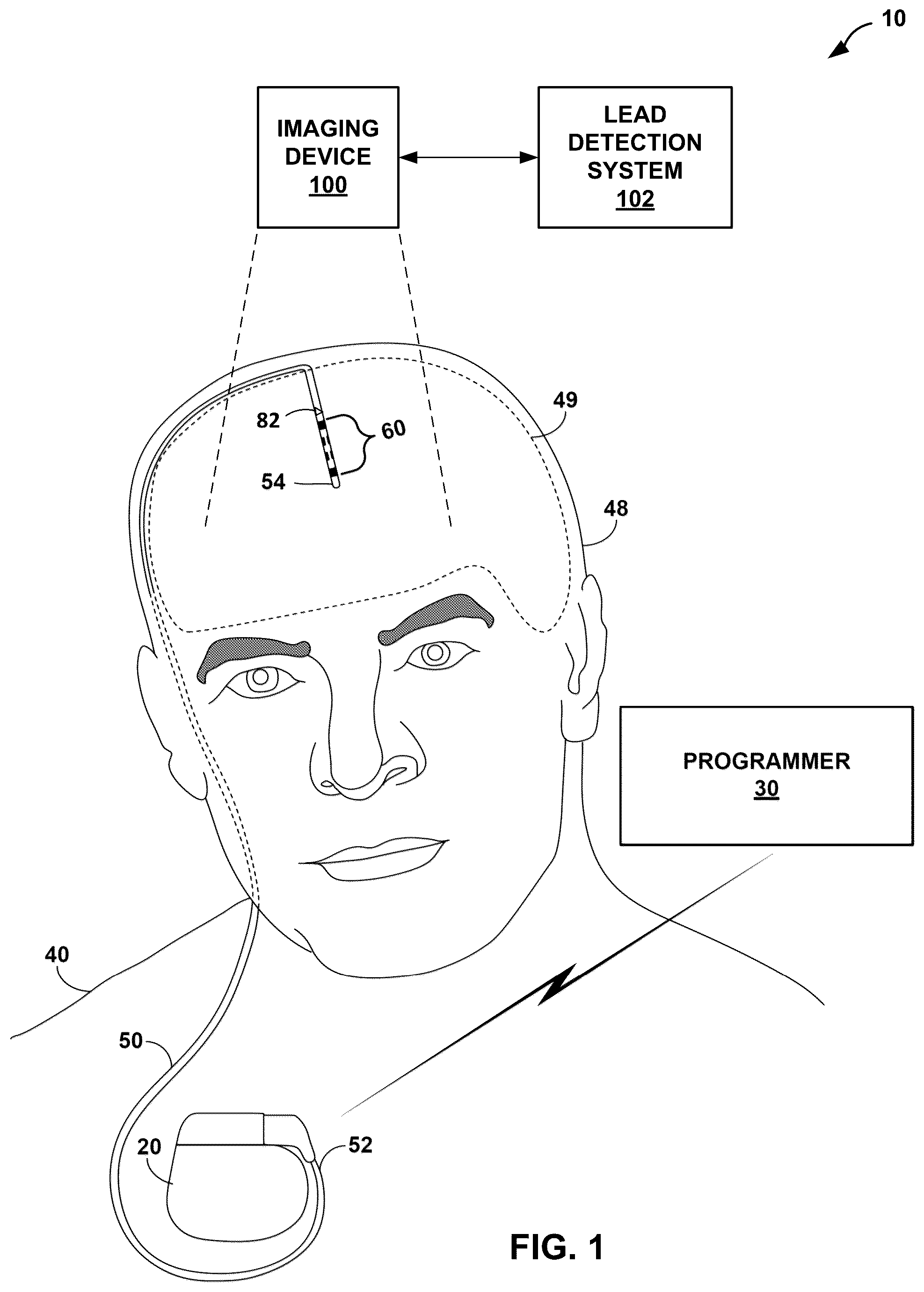 Patent US12541874 — Lead orientation determination for electrical stimulation therapy — Figure 1