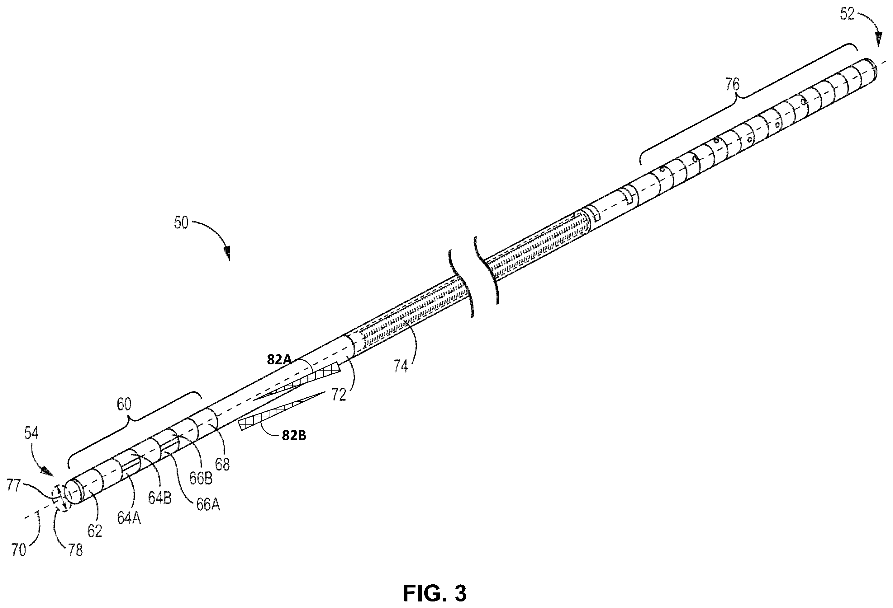 Patent US12541874 Figure 3 – Lead orientation determination for electrical stimulation therapy