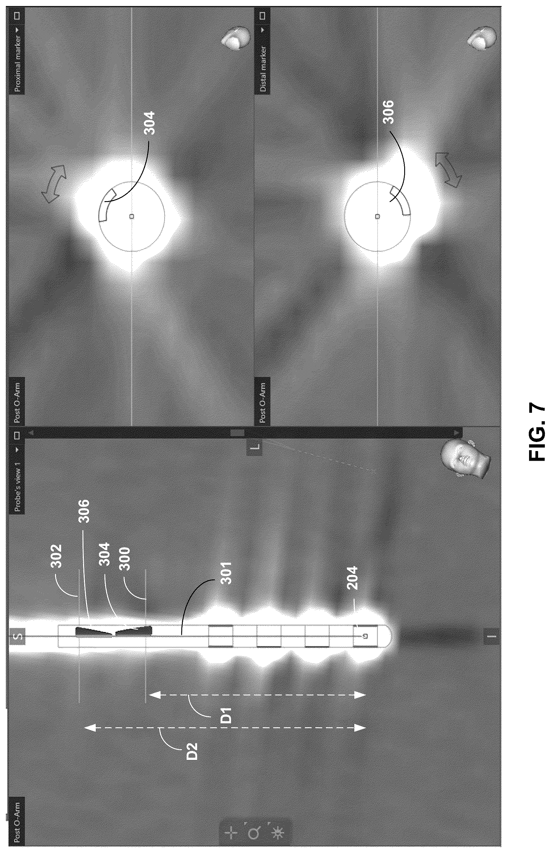 Patent US12541874 Figure 7 – Lead orientation determination for electrical stimulation therapy