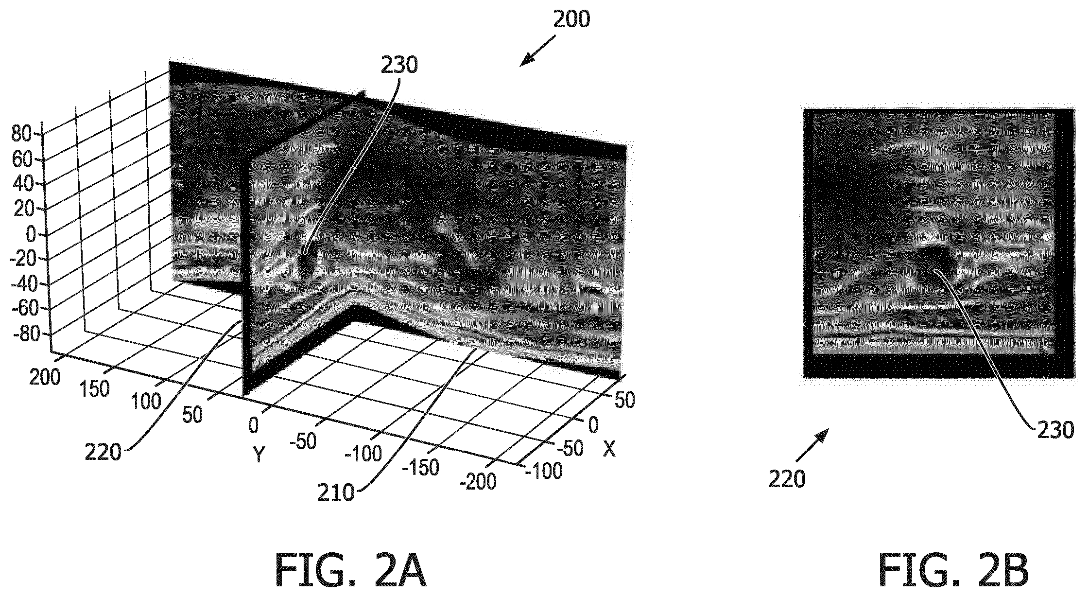 Patent US12541893 Figure 2 – Bi-plane and three-dimensional ultrasound image acquisition for generating roadmap images, and associated systems and devices