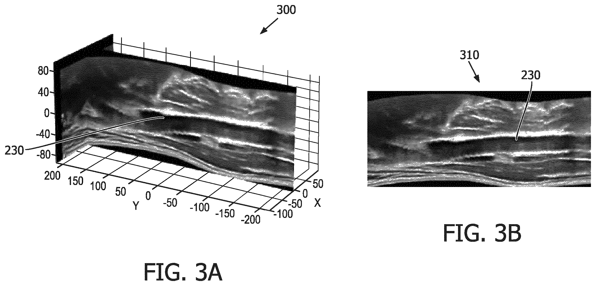 Patent US12541893 Figure 3 – Bi-plane and three-dimensional ultrasound image acquisition for generating roadmap images, and associated systems and devices