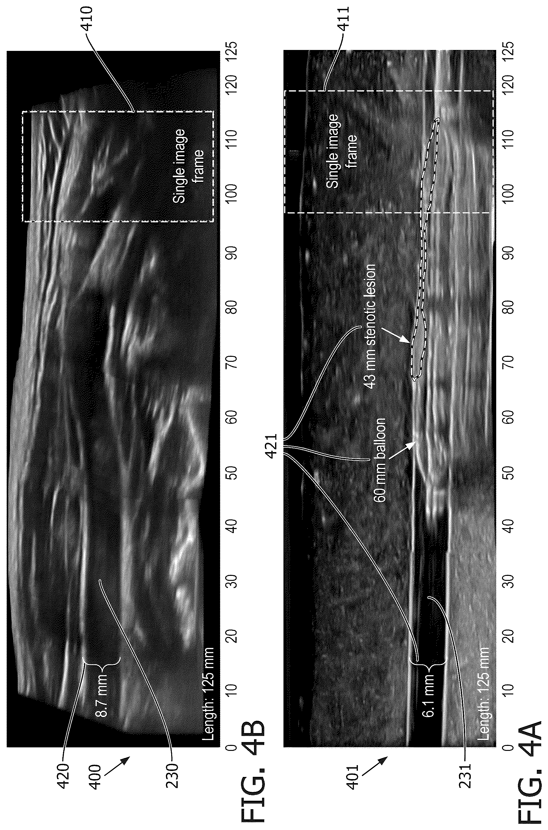 Patent US12541893 Figure 4 – Bi-plane and three-dimensional ultrasound image acquisition for generating roadmap images, and associated systems and devices