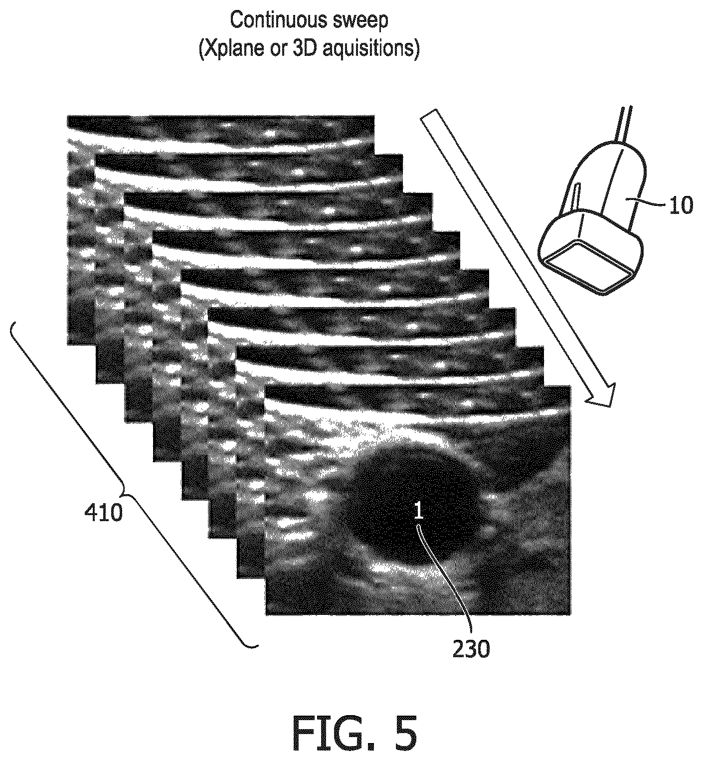 Patent US12541893 Figure 5 – Bi-plane and three-dimensional ultrasound image acquisition for generating roadmap images, and associated systems and devices