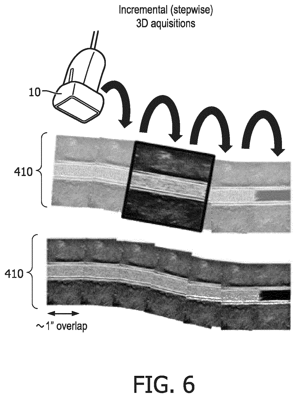 Patent US12541893 Figure 6 – Bi-plane and three-dimensional ultrasound image acquisition for generating roadmap images, and associated systems and devices