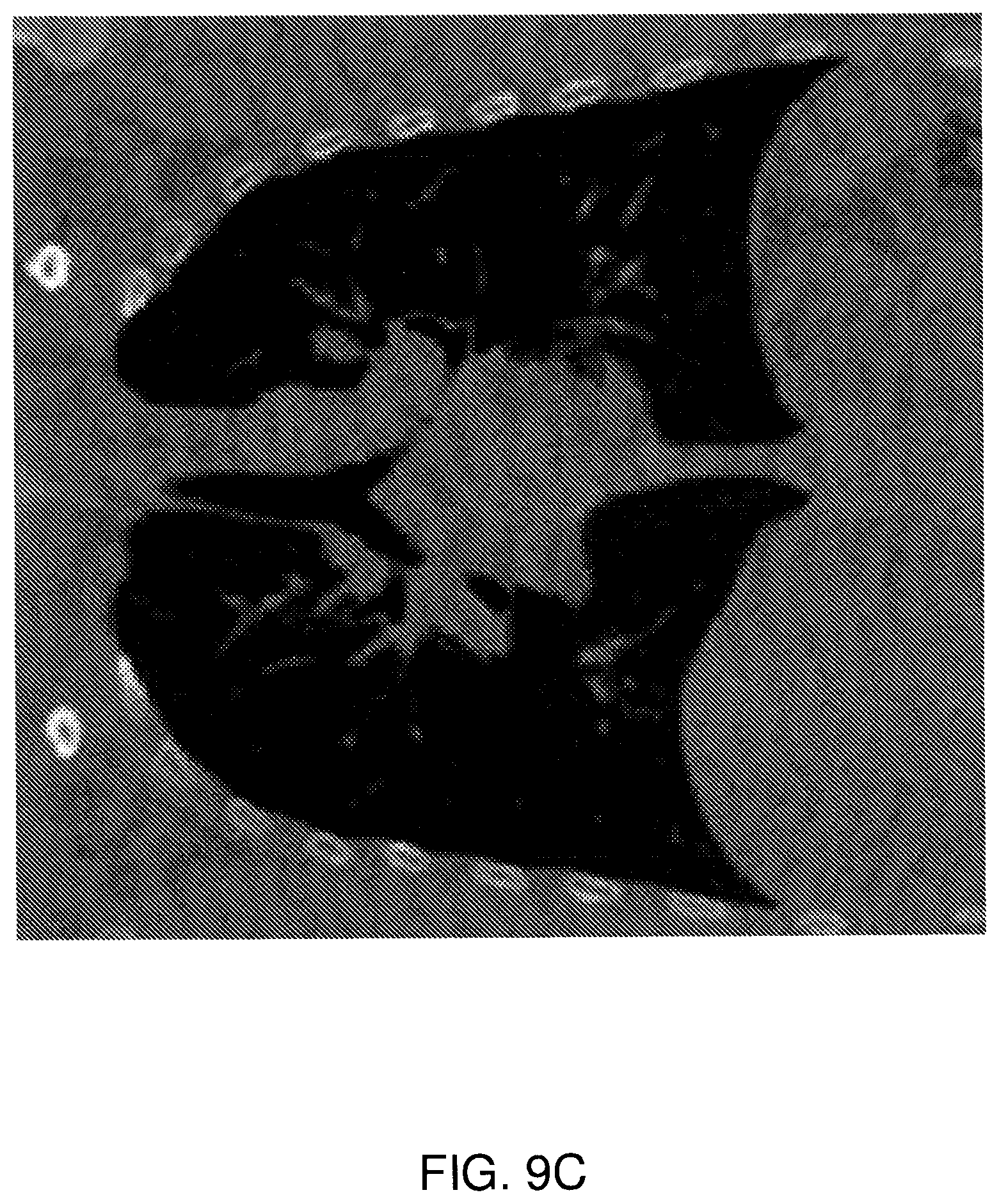 Patent US12541900 Figure 11 – Accelerated image reconstruction systems including an x-ray tomography image reconstruction system using a projection operator matrix