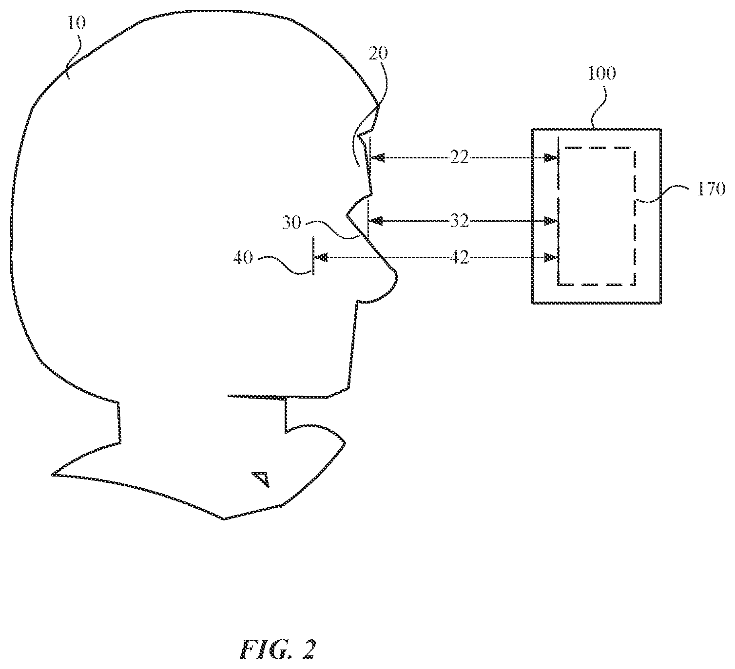 Patent US12547007 Figure 2 – Fit detection for head-mountable devices