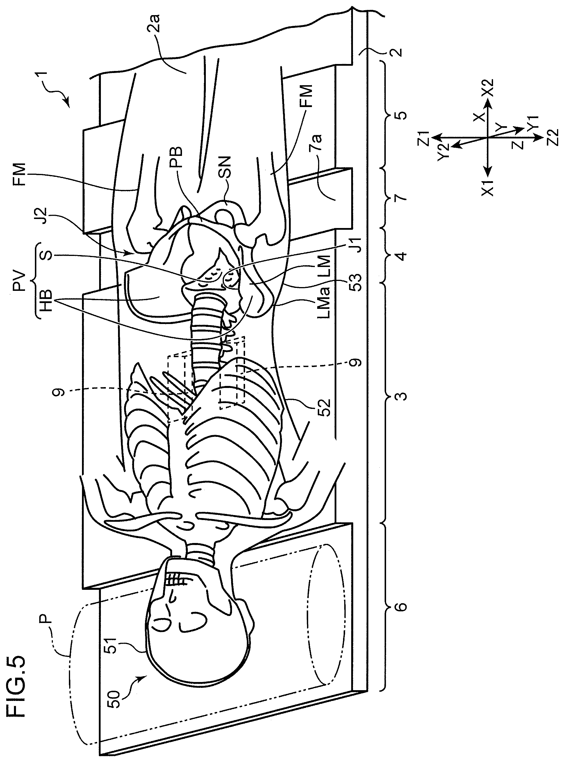 Patent US12551026 Figure 4 – Supine respiration mat