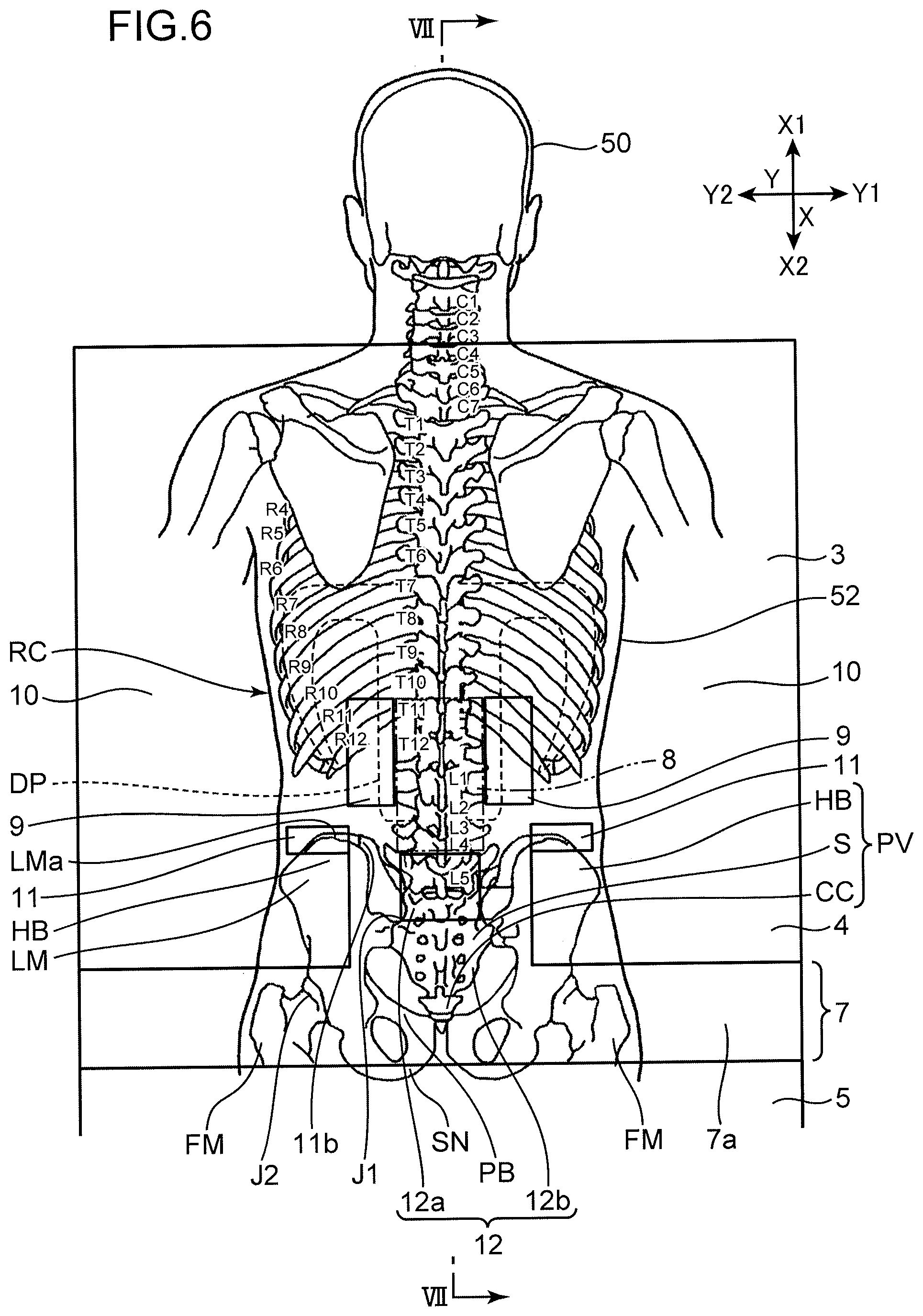 Patent US12551026 Figure 5 – Supine respiration mat