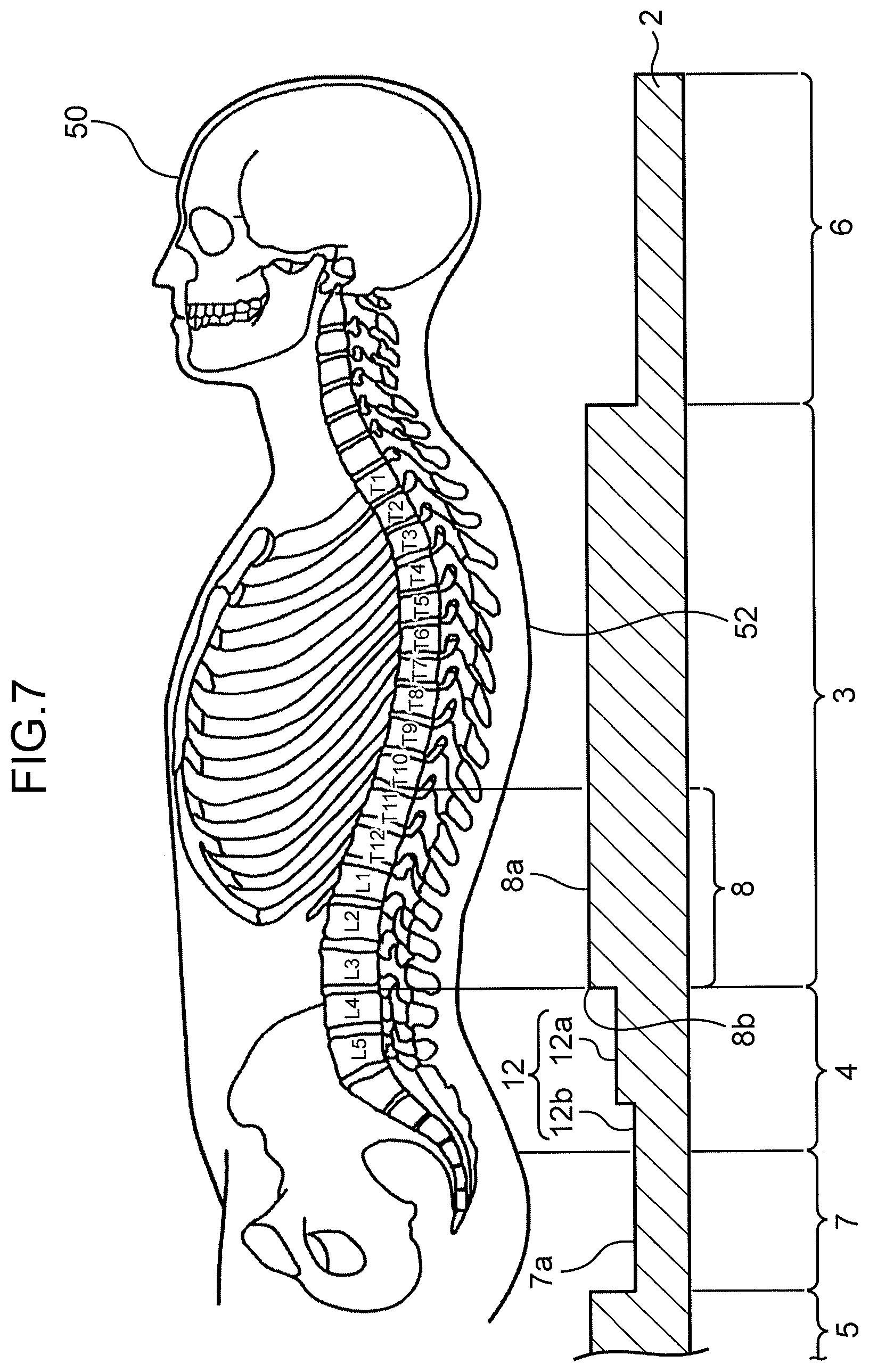 Patent US12551026 Figure 6 – Supine respiration mat
