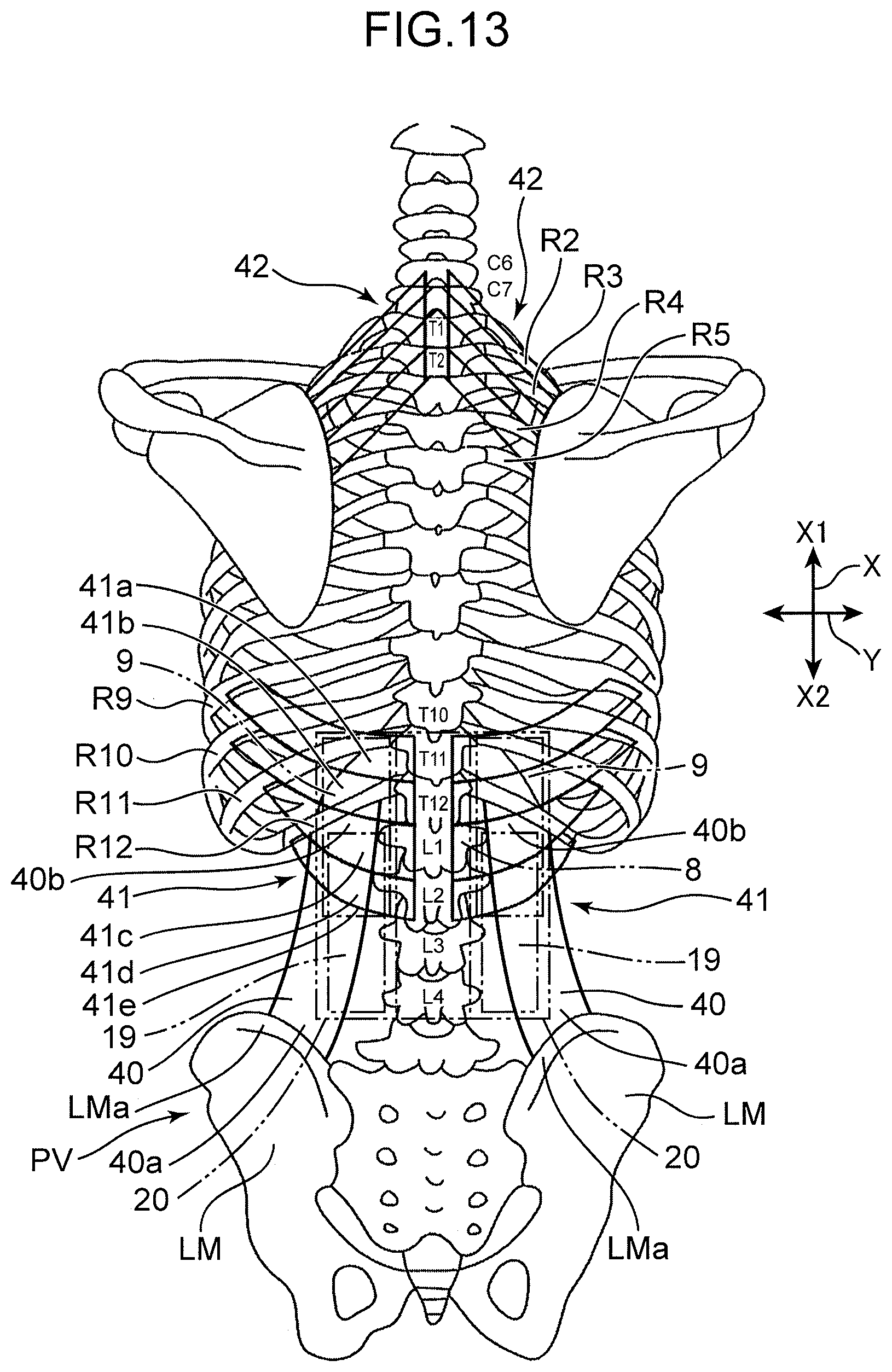 Patent US12551026 Figure 11 – Supine respiration mat