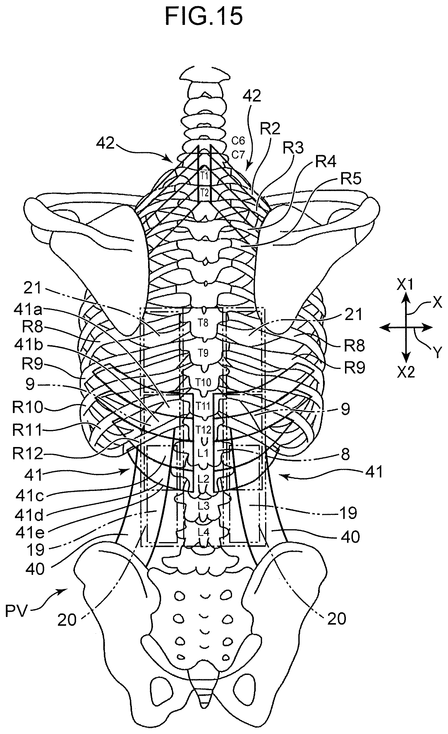 Patent US12551026 Figure 13 – Supine respiration mat