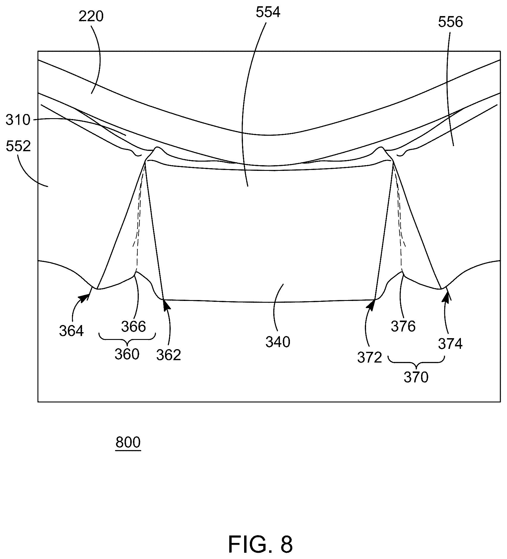 Patent US12551036 Figure 4 – Bed skirt system for adjustable bed