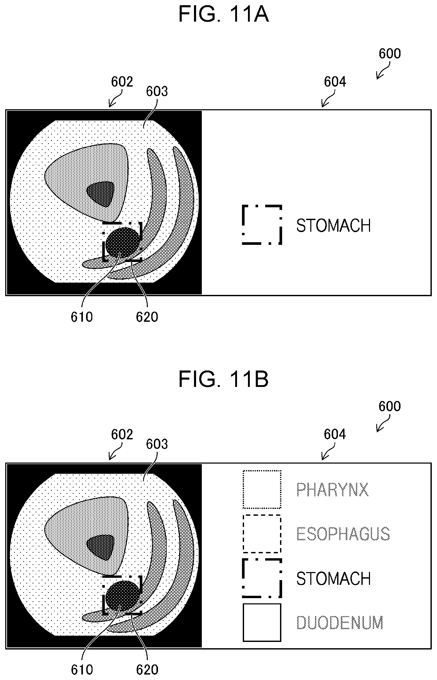 Patent US12551089 Figure 10 – Medical image processing apparatus, endoscope system, medical image processing method, and medical image processing program for switching between detection processes