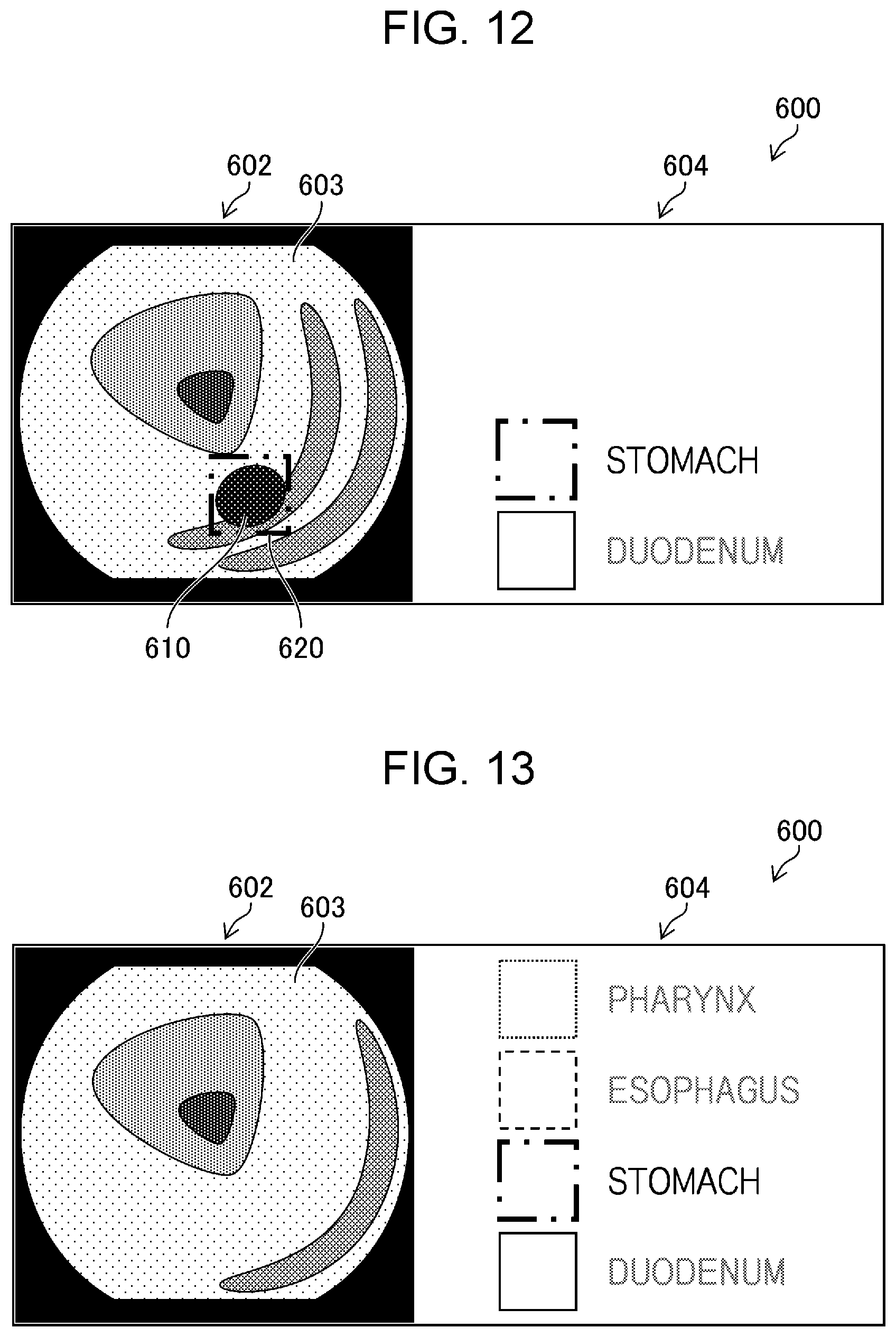 Patent US12551089 Figure 11 – Medical image processing apparatus, endoscope system, medical image processing method, and medical image processing program for switching between detection processes