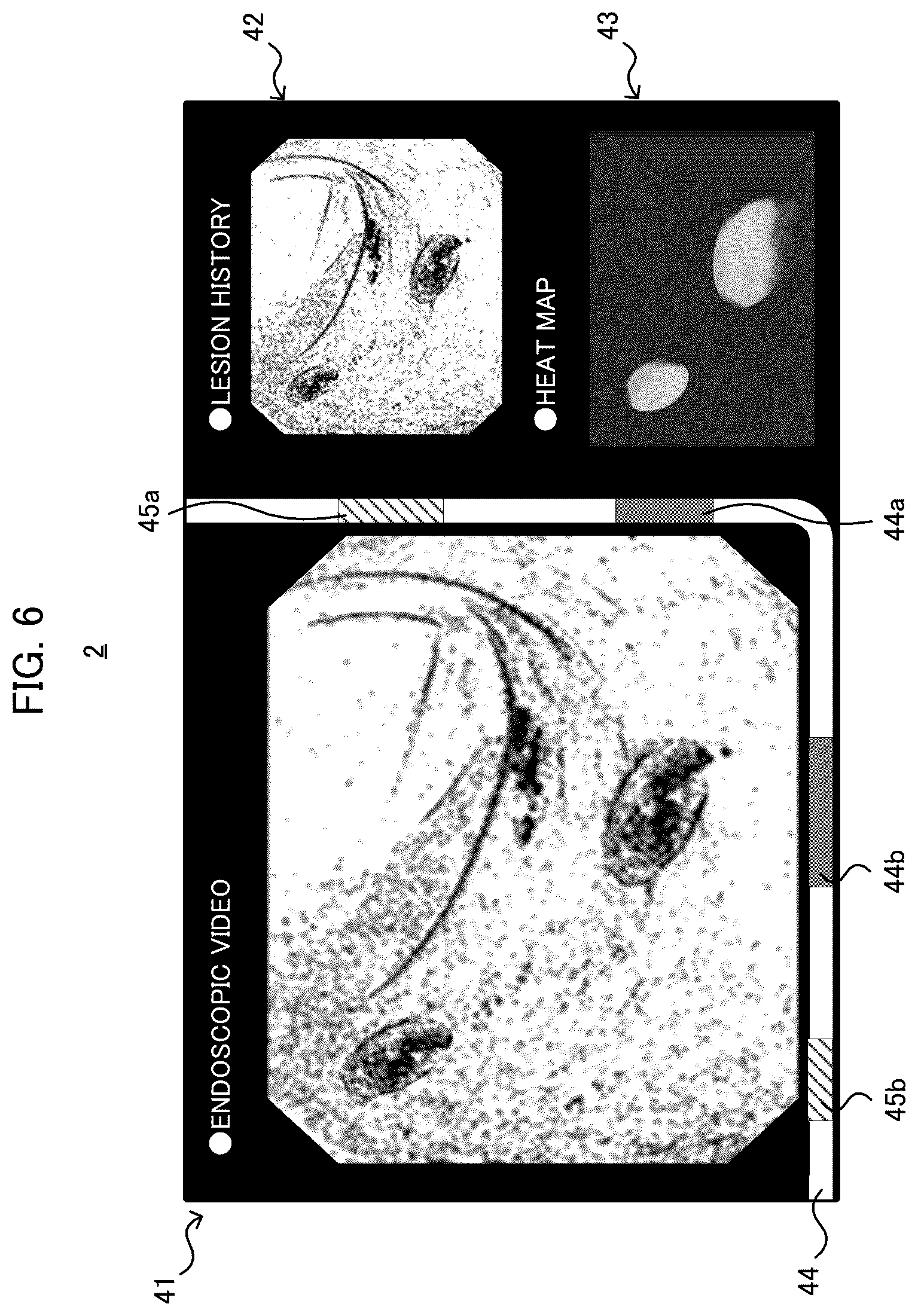 Patent US12551090 Figure 6 – Endoscopic examination support apparatus, endoscopic examination support method, and recording medium