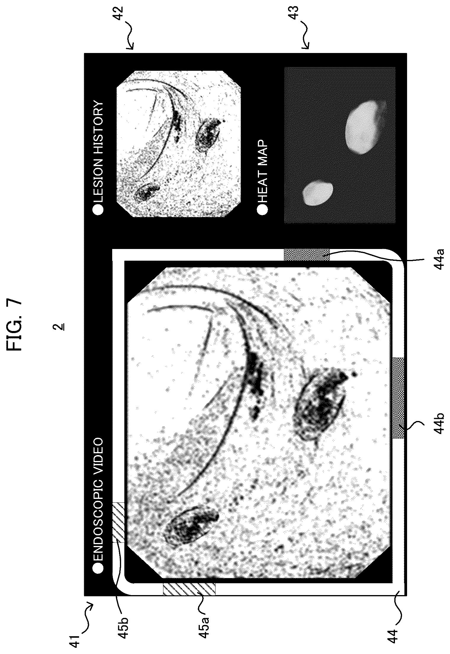 Patent US12551090 Figure 7 – Endoscopic examination support apparatus, endoscopic examination support method, and recording medium